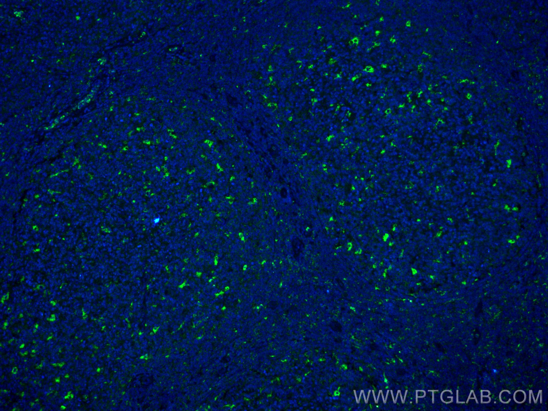 IF Staining of human tonsillitis using CL488-25747