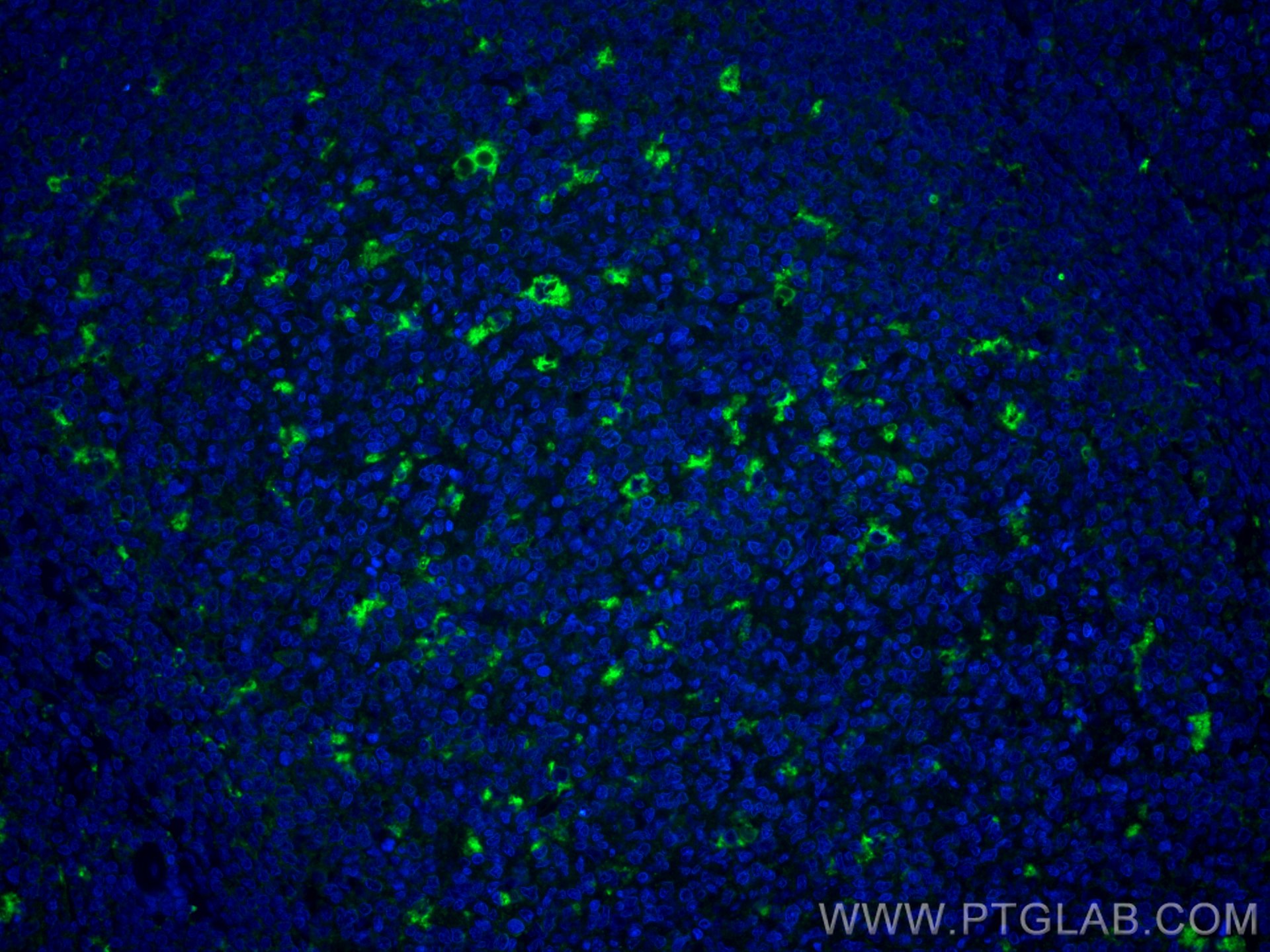 IF Staining of human tonsillitis using CL488-25747