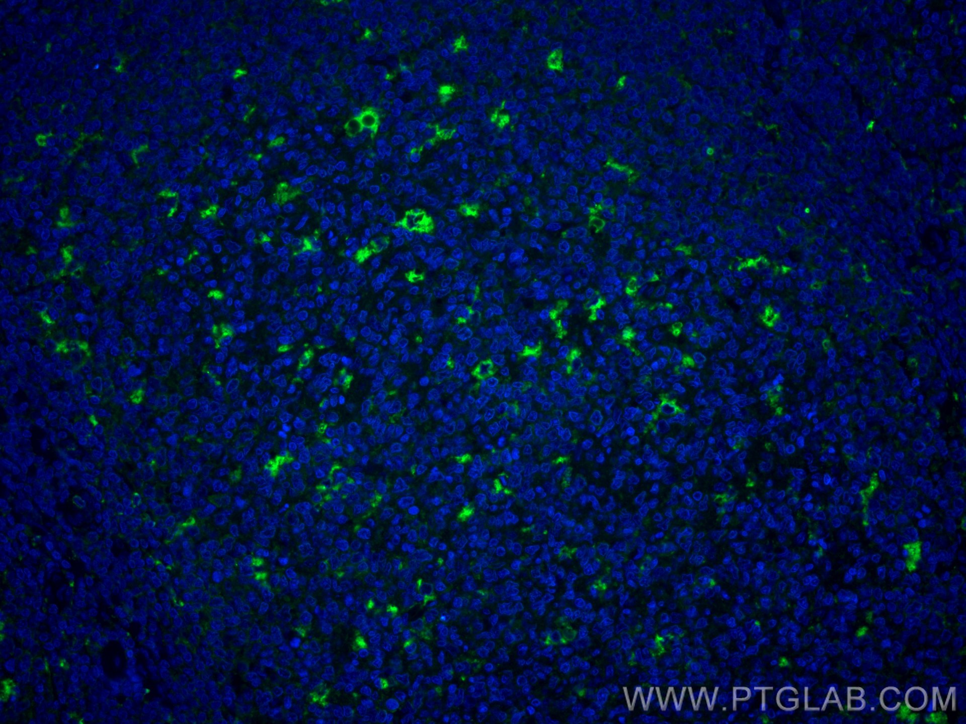 IF Staining of human tonsillitis using CL488-25747