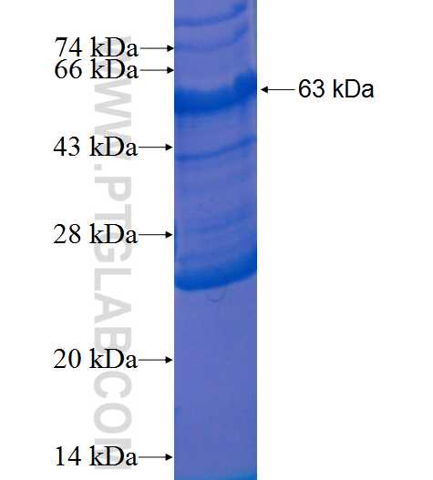 CD68 fusion protein Ag1215 SDS-PAGE CD68 fusion protein Ag1215 SDS-PAGE