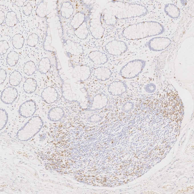 IHC staining of human large intestine using 60209-2-Ig IHC staining of human large intestine using 60209-2-Ig