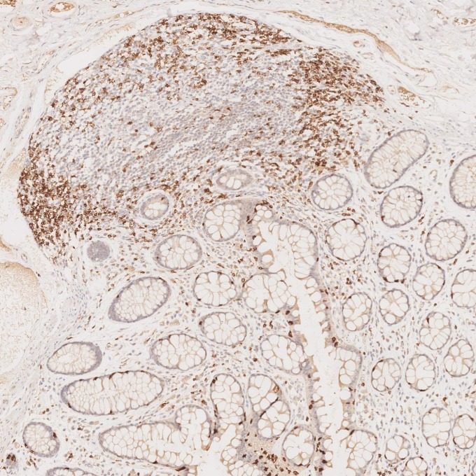 IHC staining of human large intestine using 60209-2-Ig IHC staining of human large intestine using 60209-2-Ig