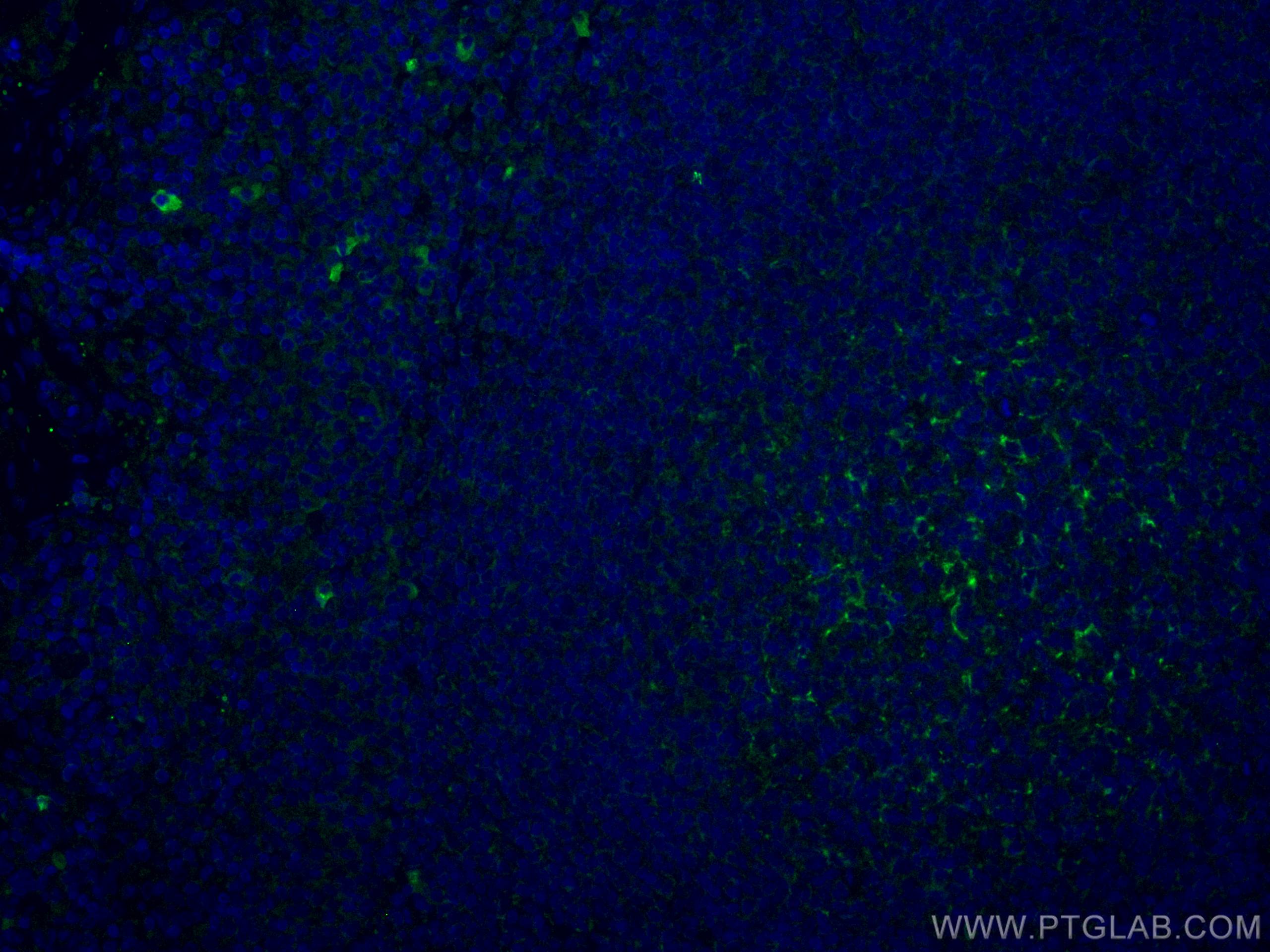 IF Staining of human tonsillitis using CL488-67749