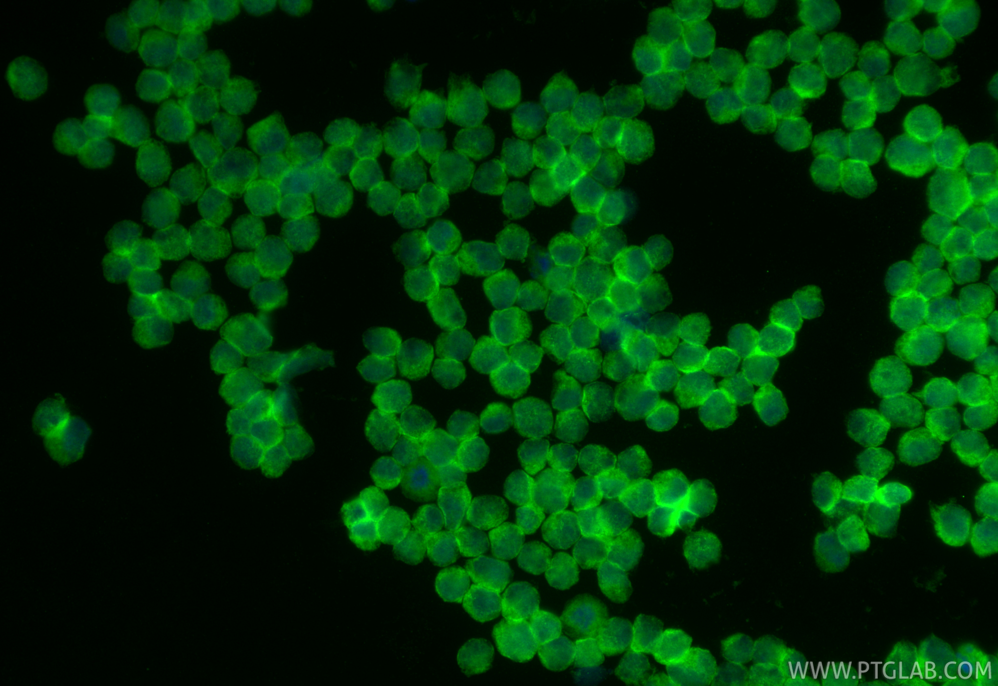 IF Staining of Raji using CL488-67749 IF Staining of Raji using CL488-67749