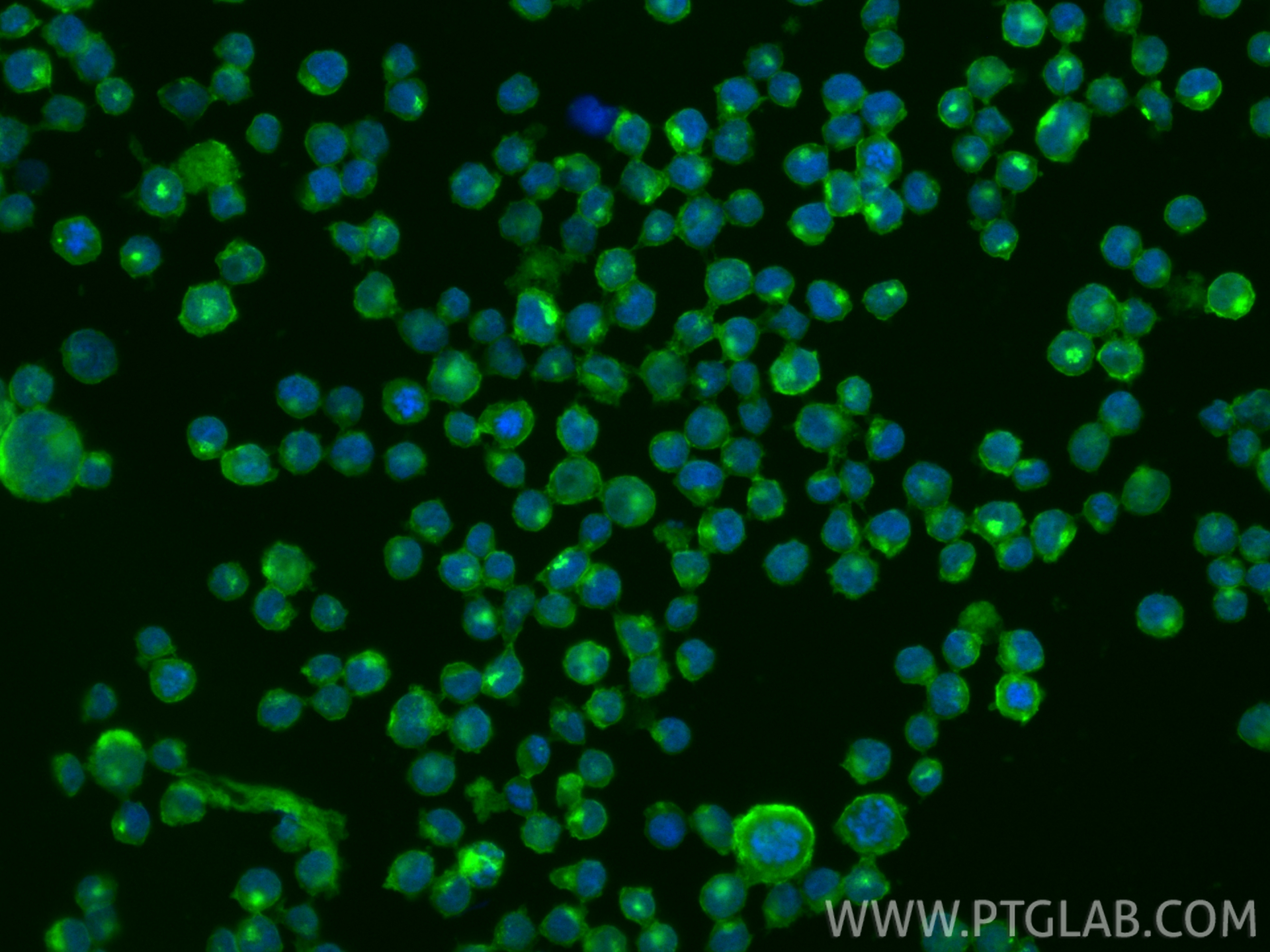 IF Staining of Raji using CL488-84455-2 IF Staining of Raji using CL488-84455-2
