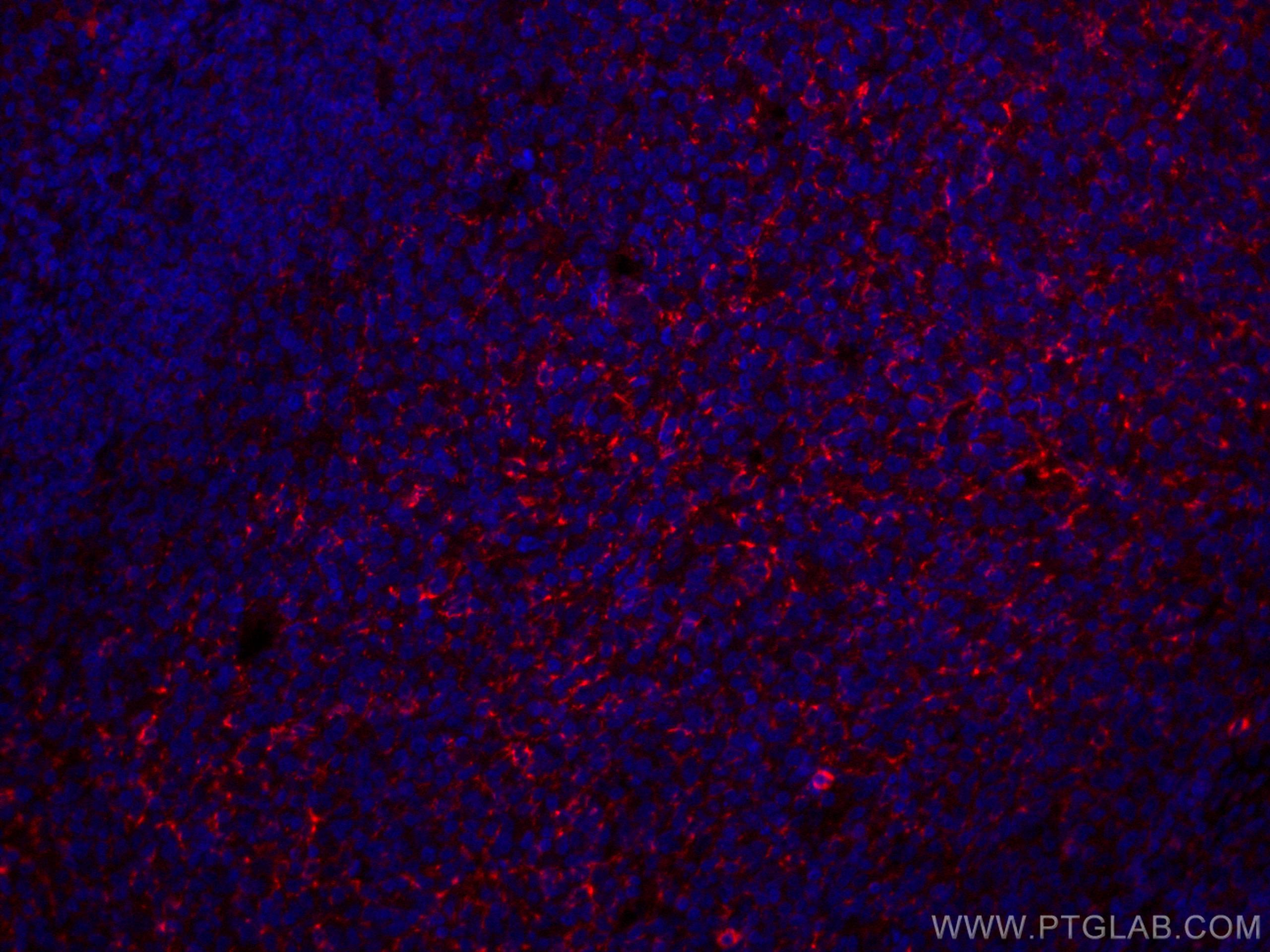 IF Staining of human tonsillitis using CL647-67749