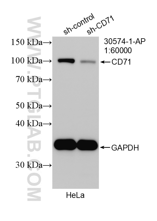 WB analysis of HeLa using 30574-1-AP WB analysis of HeLa using 30574-1-AP