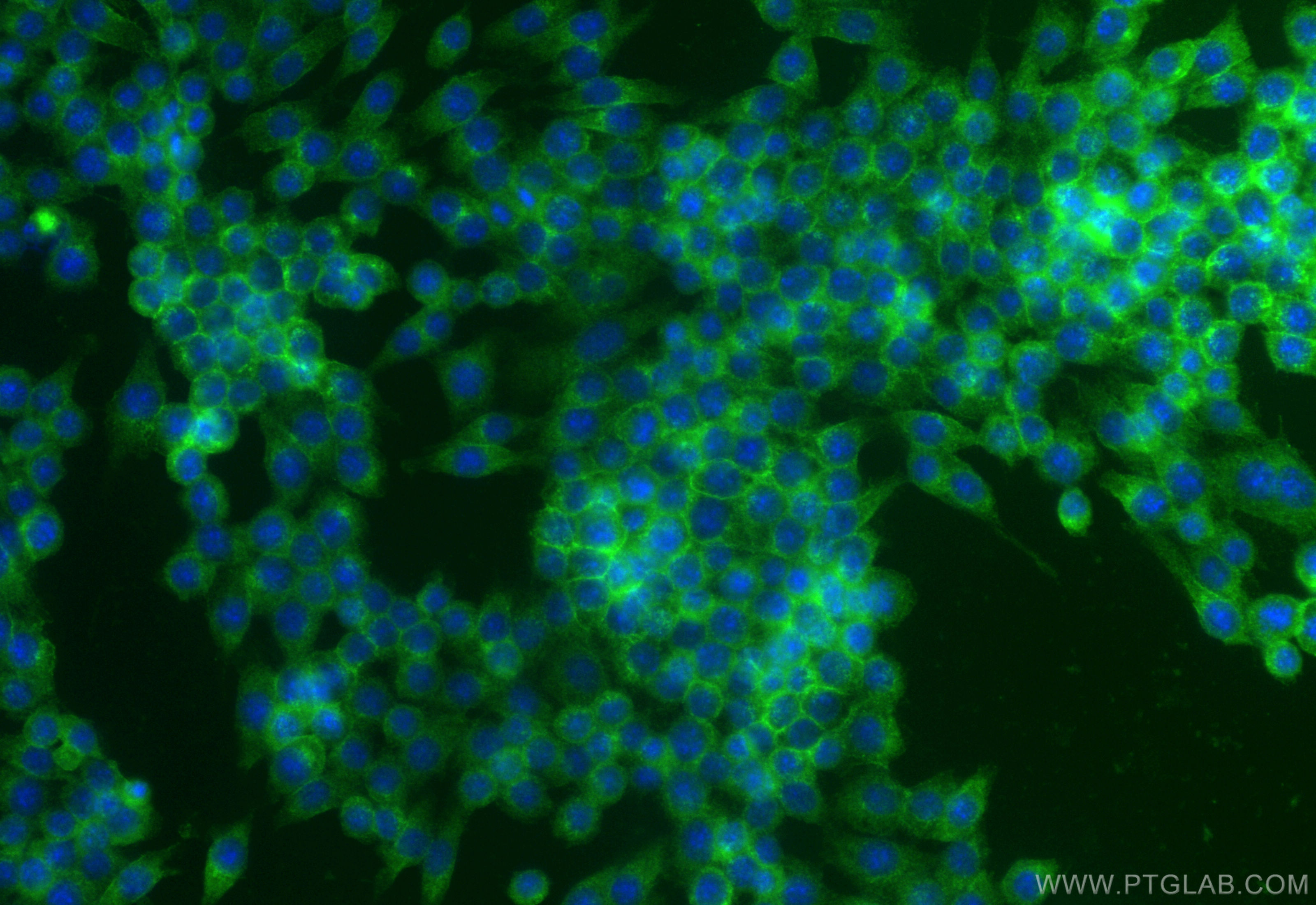 IF Staining of RAW 264.7 using 32333-1-AP