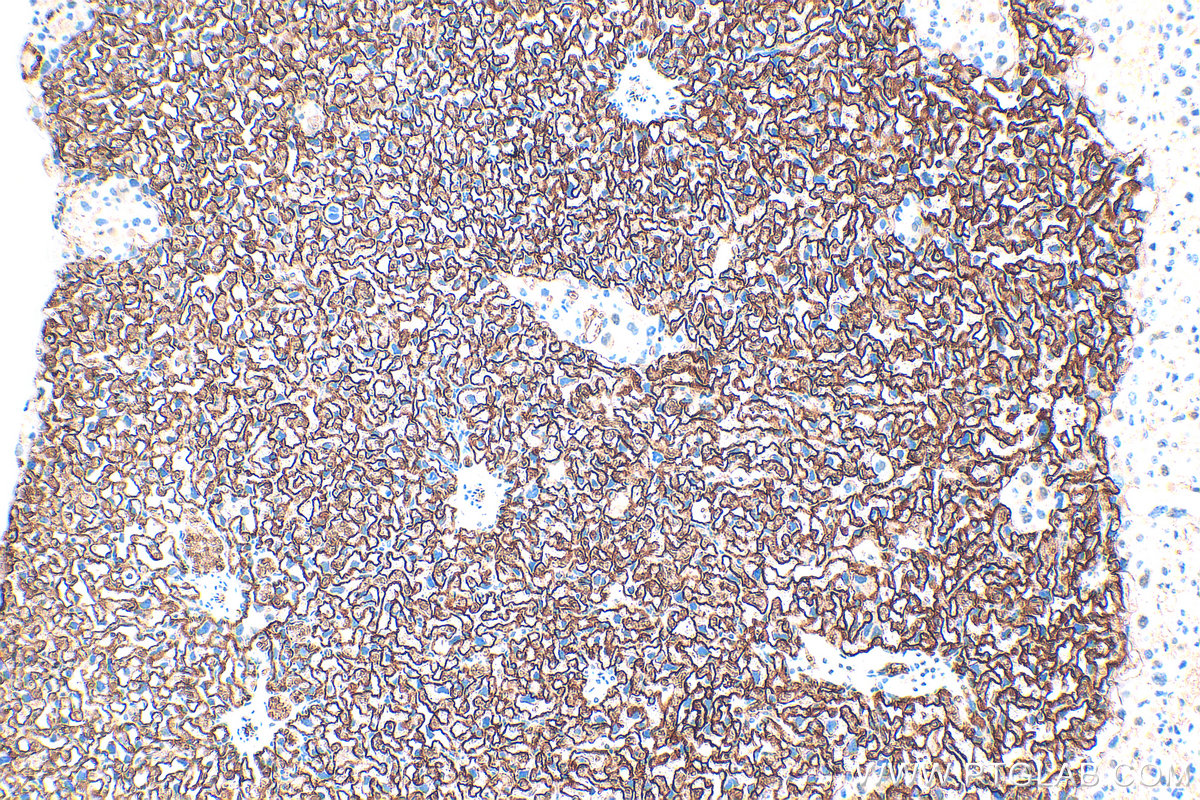 IHC staining of mouse placenta using 32333-1-AP