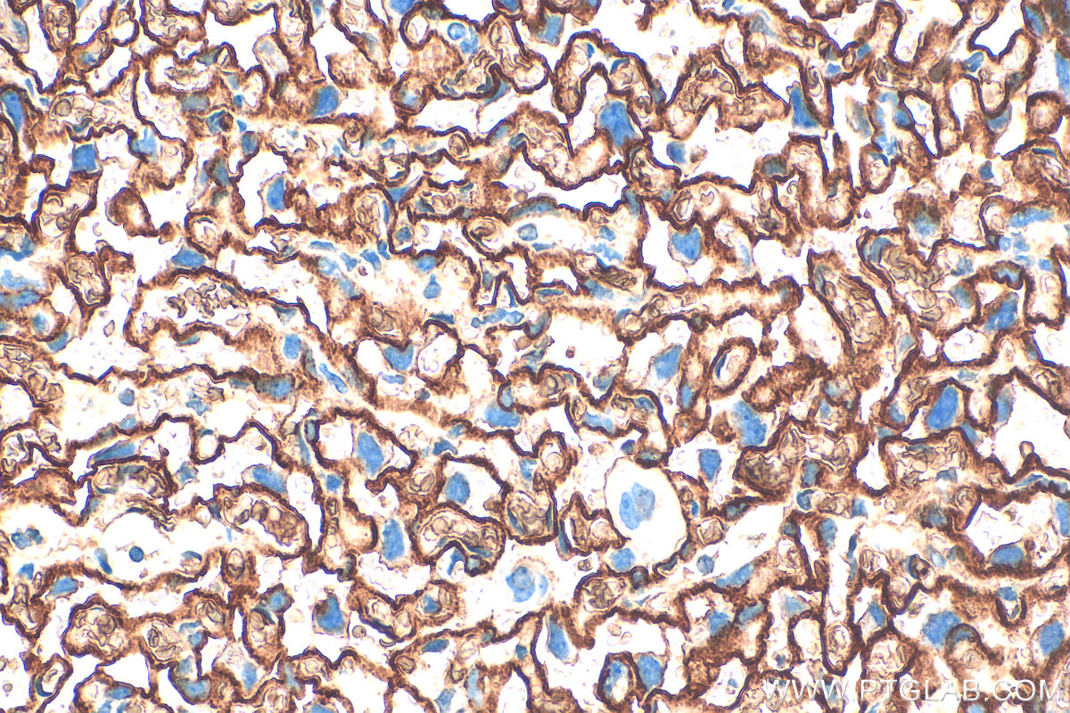 IHC staining of mouse placenta using 32333-1-AP