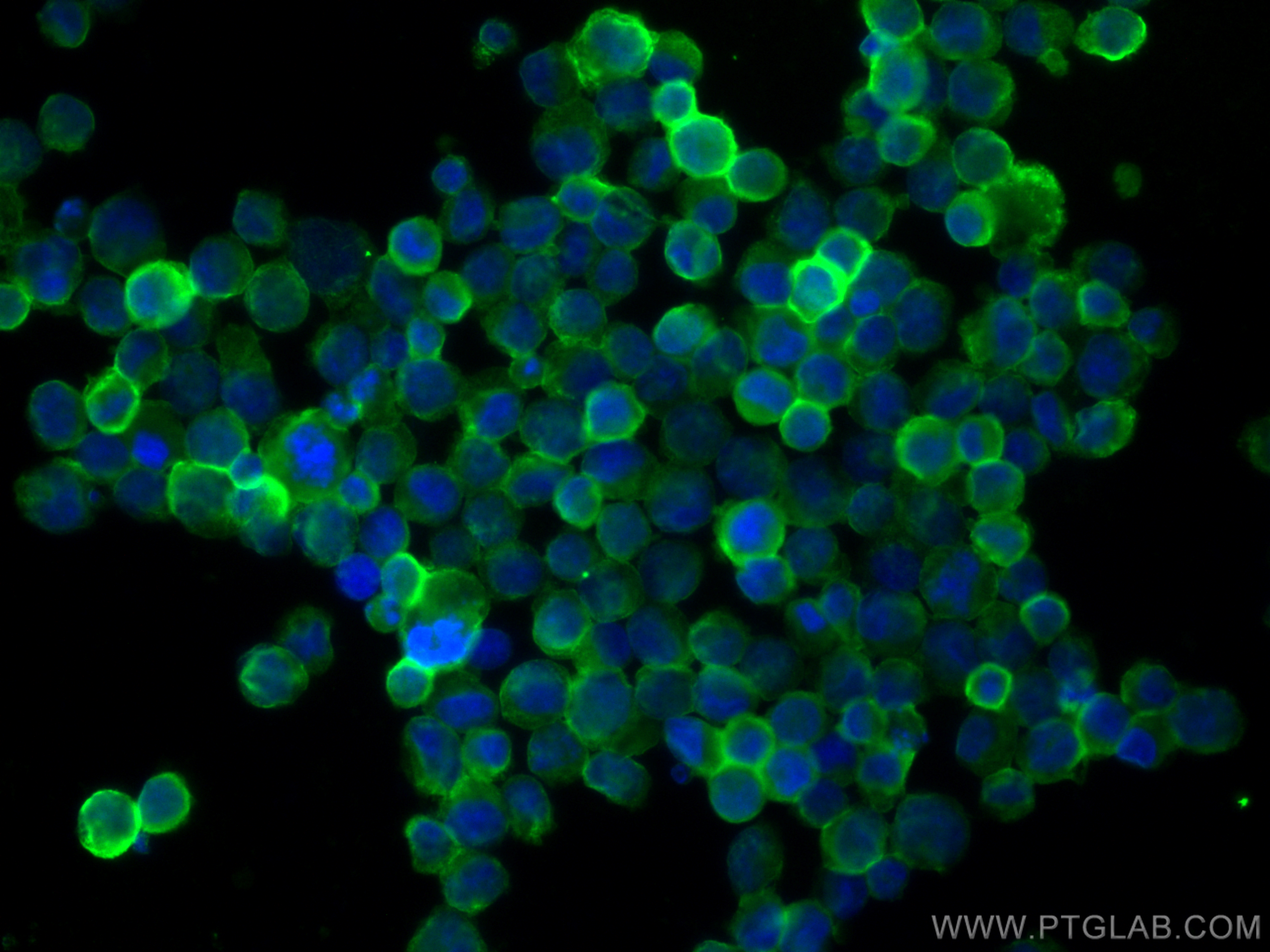 IF Staining of K-562 using 66180-1-Ig (same clone as 66180-1-PBS)