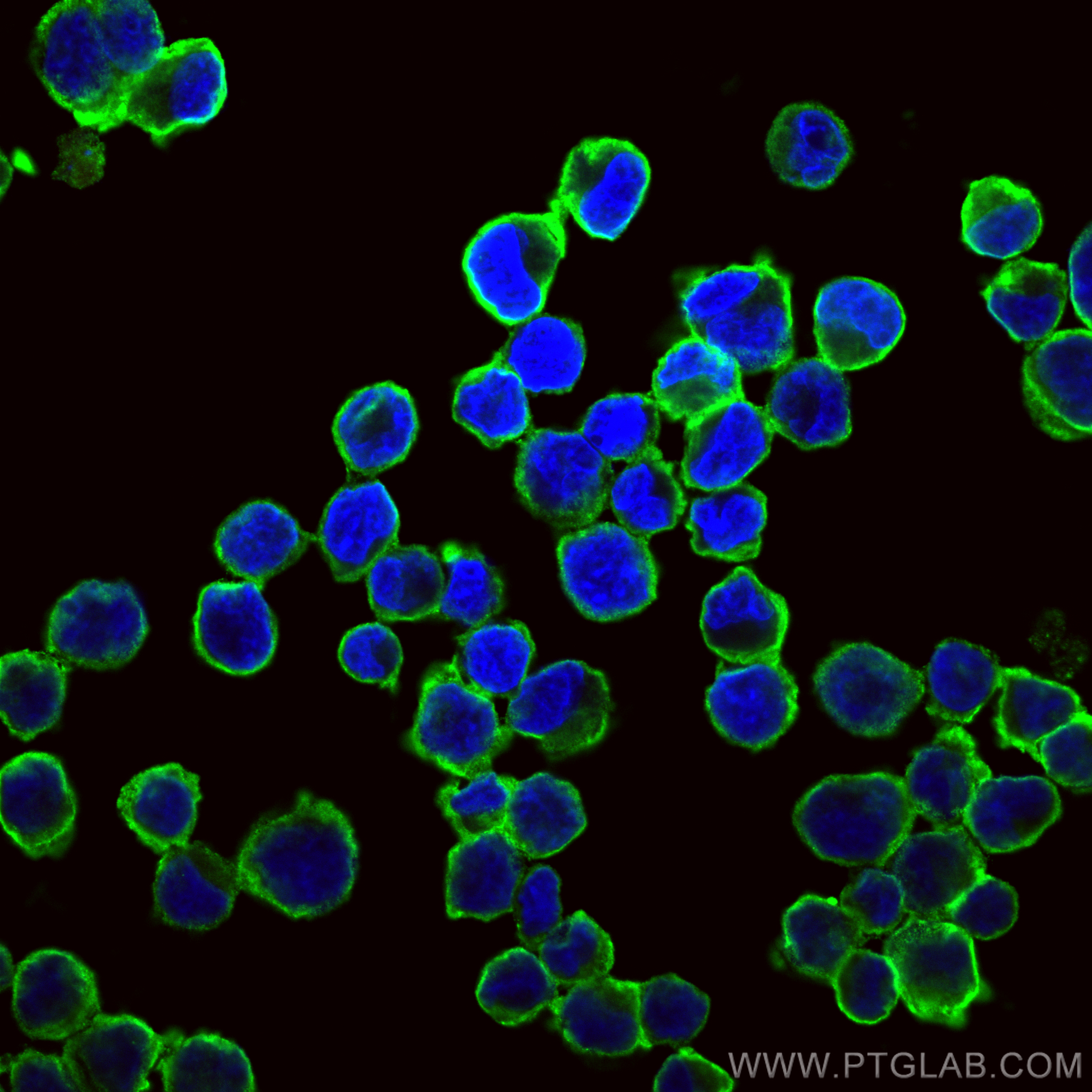 IF Staining of K-562 using 66180-1-Ig (same clone as 66180-1-PBS)