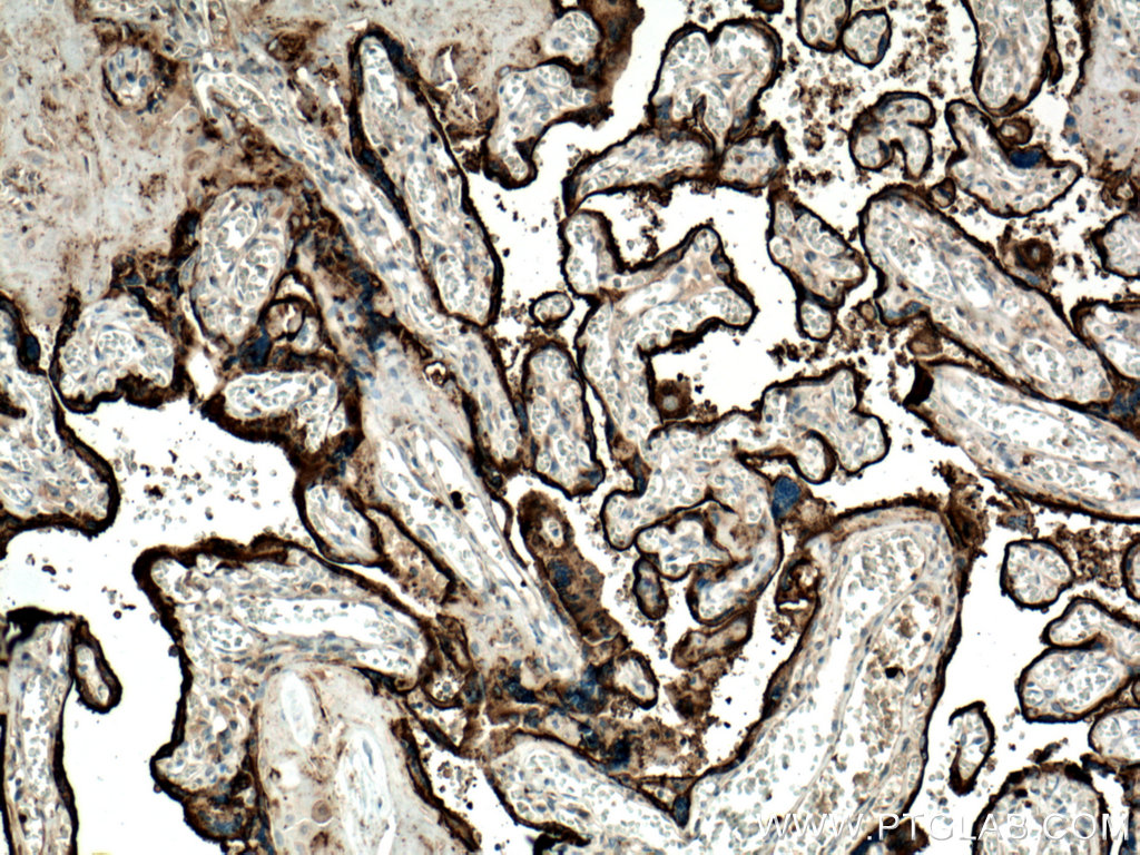 IHC staining of human placenta using 66180-1-Ig