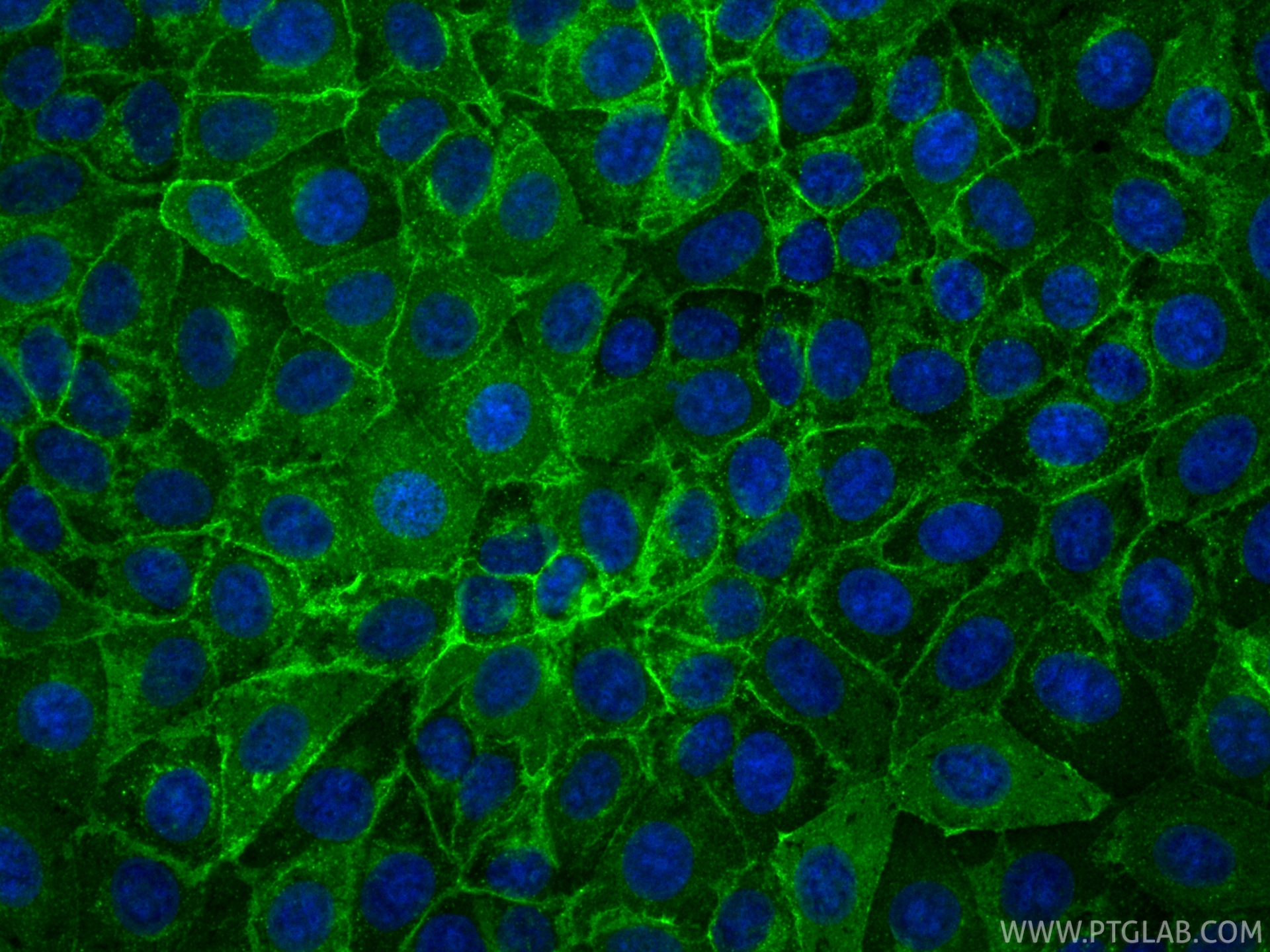 IF Staining of MCF-7 using 81793-13-RR IF Staining of MCF-7 using 81793-13-RR