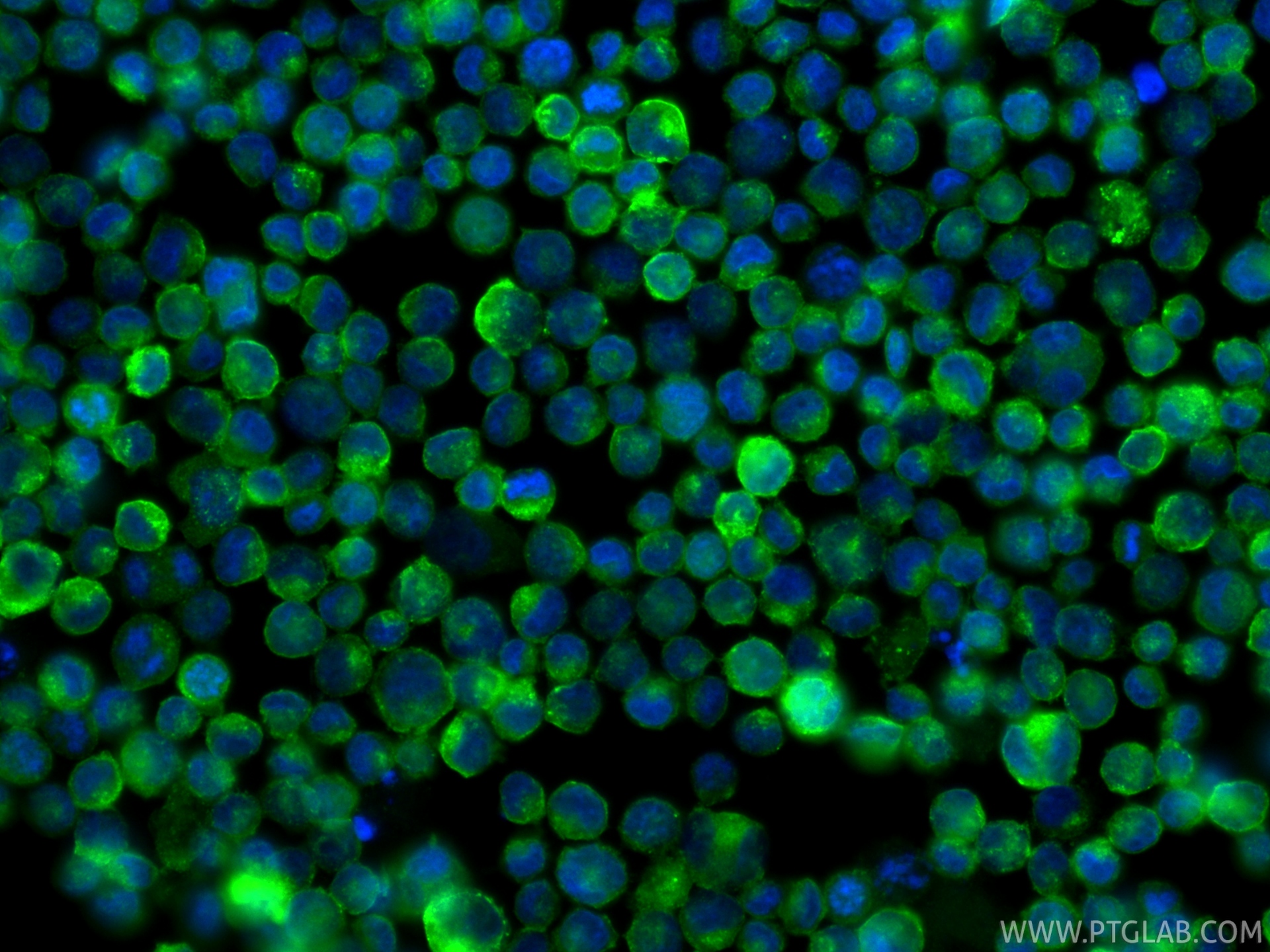 IF Staining of K-562 using 81793-14-RR