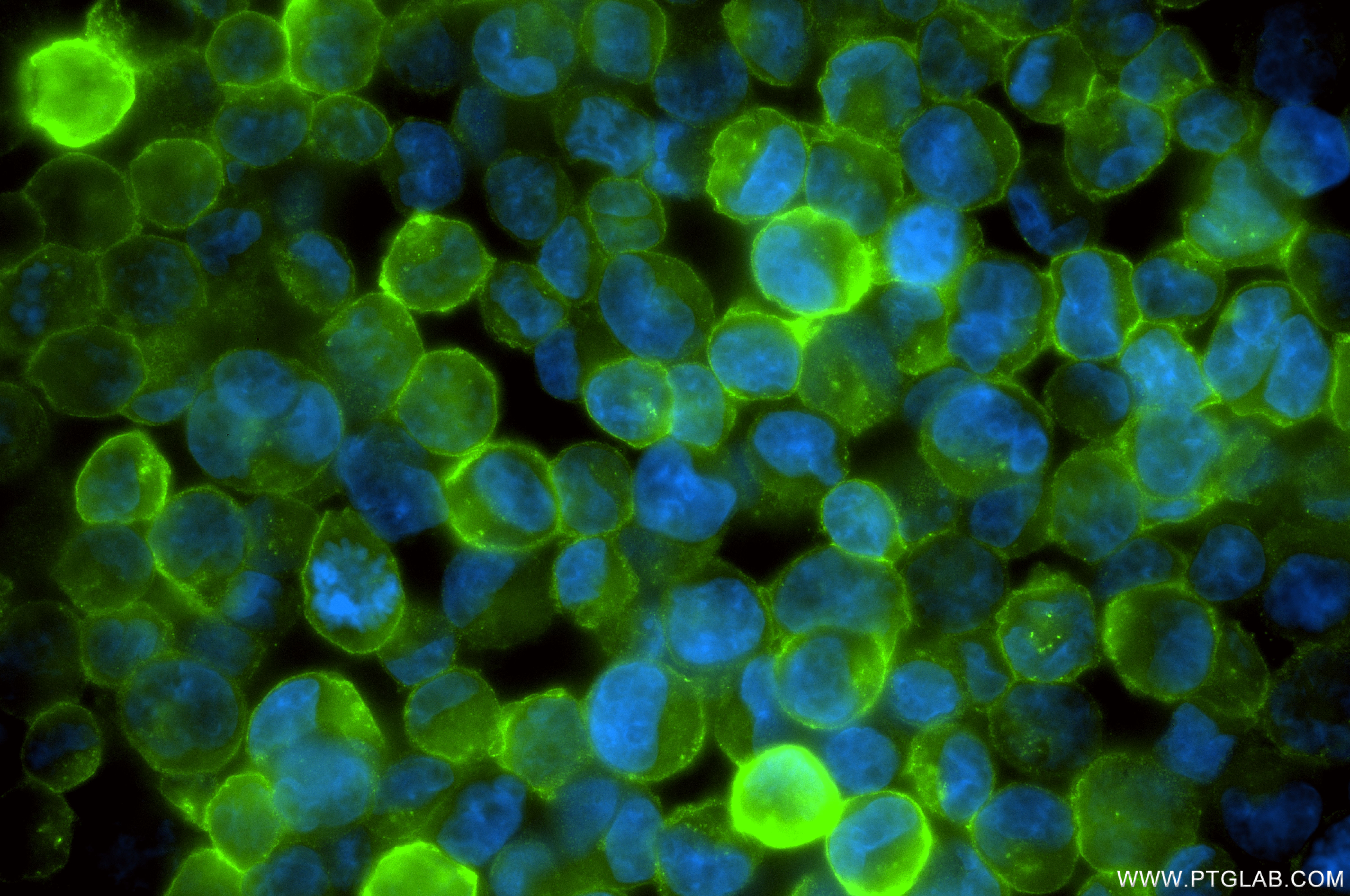 IF Staining of K-562 using 81793-3-RR (same clone as 81793-3-PBS)