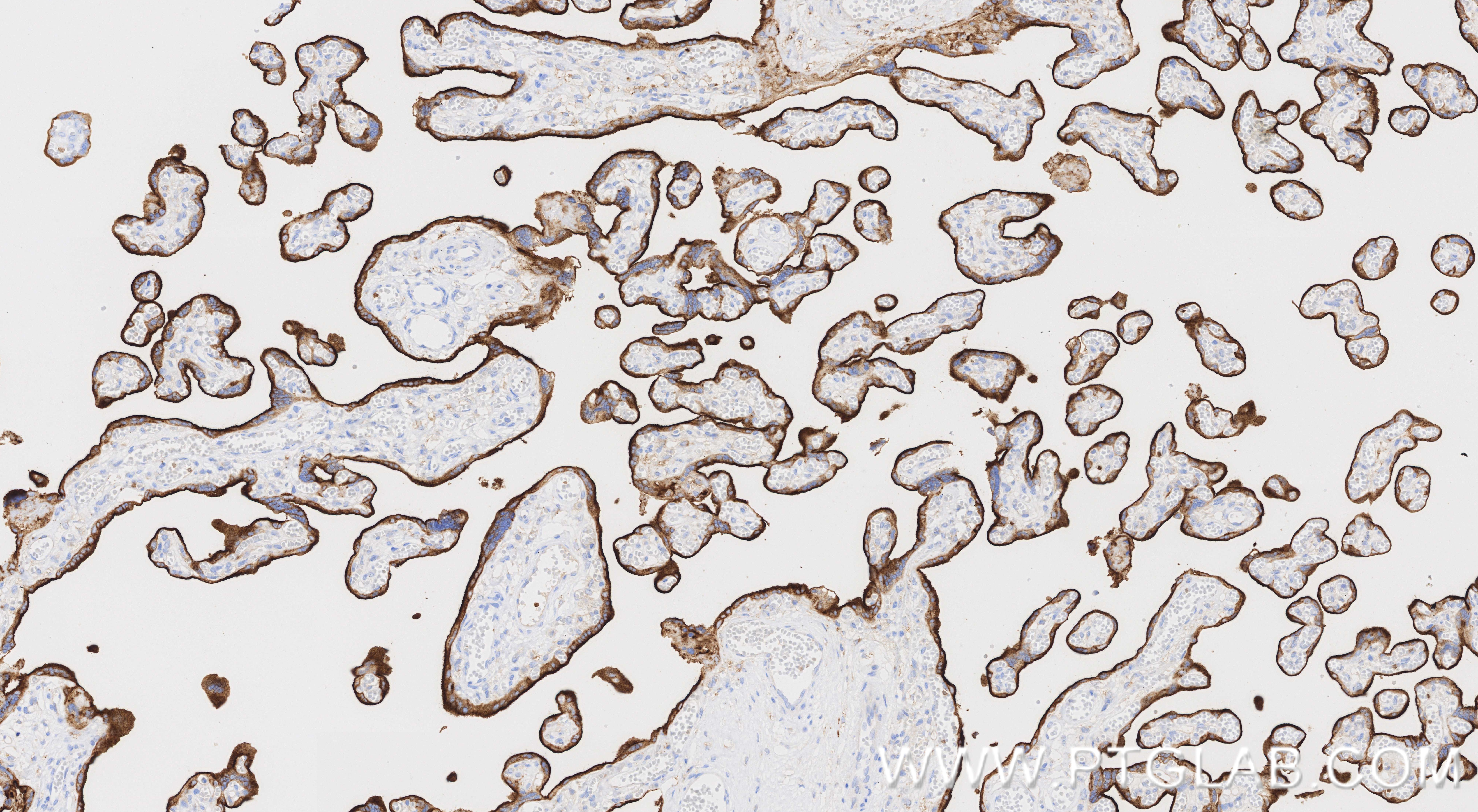 IHC staining of human placenta using 81793-3-RR IHC staining of human placenta using 81793-3-RR