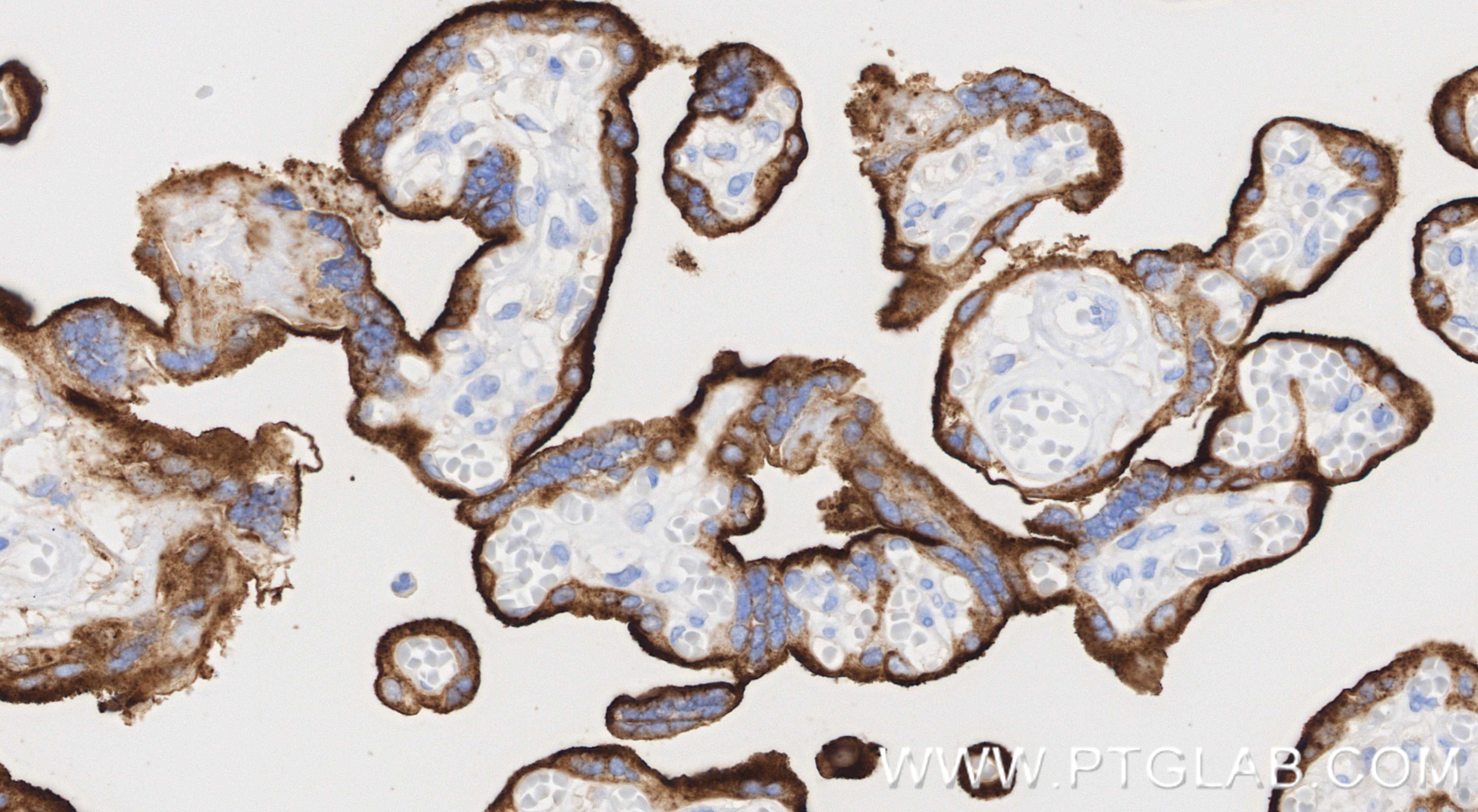 IHC staining of human placenta using 81793-3-RR IHC staining of human placenta using 81793-3-RR