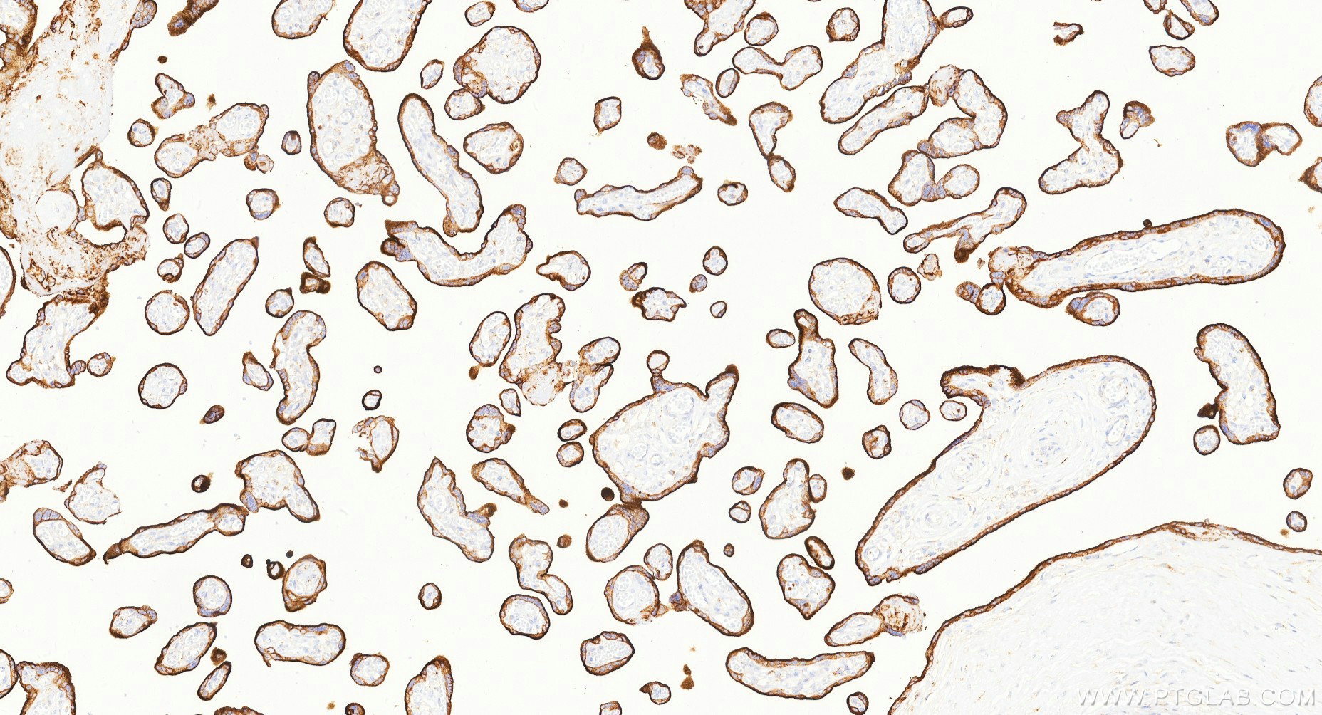 IHC staining of human placenta using Biotin-81793-13 IHC staining of human placenta using Biotin-81793-13