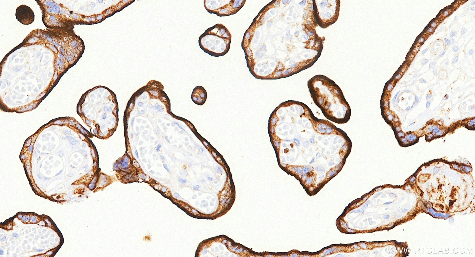 IHC staining of human placenta using Biotin-81793-13 IHC staining of human placenta using Biotin-81793-13