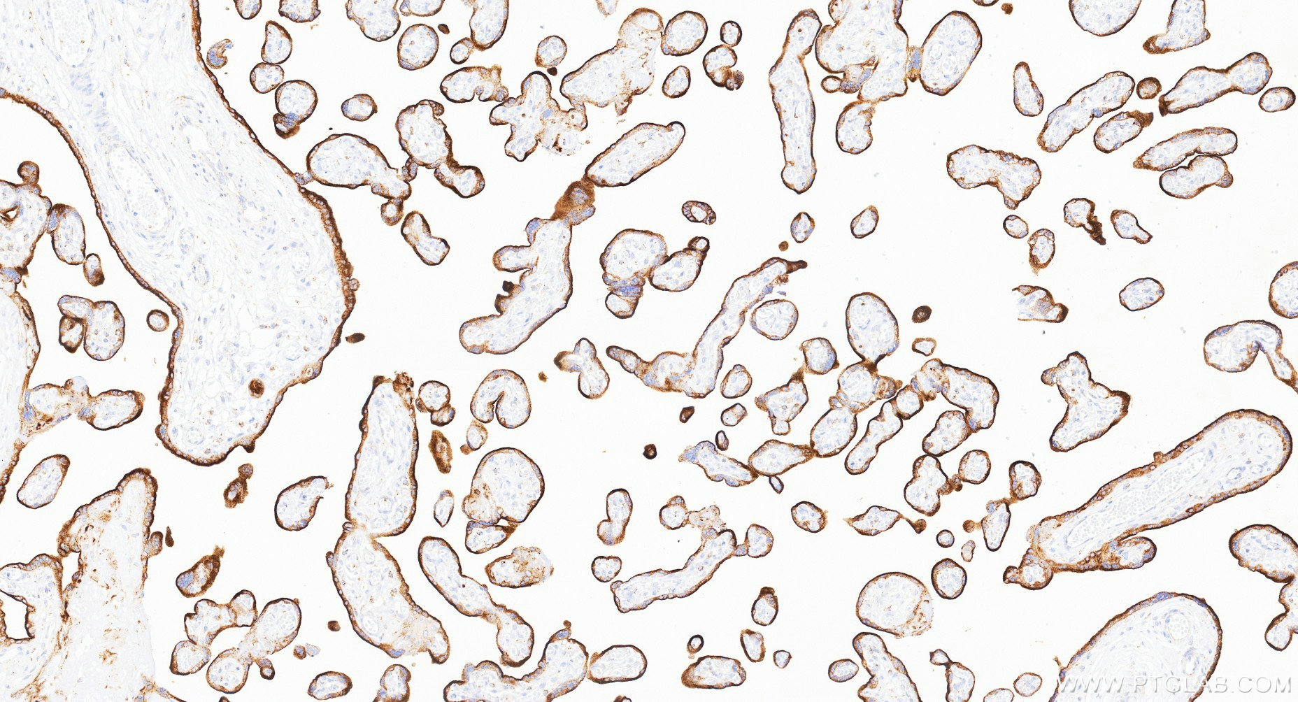 IHC staining of human placenta using Biotin-81793-14 IHC staining of human placenta using Biotin-81793-14