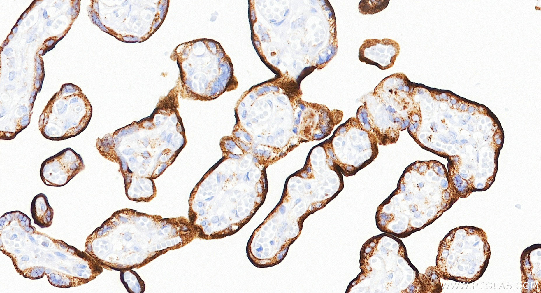 IHC staining of human placenta using Biotin-81793-14 IHC staining of human placenta using Biotin-81793-14