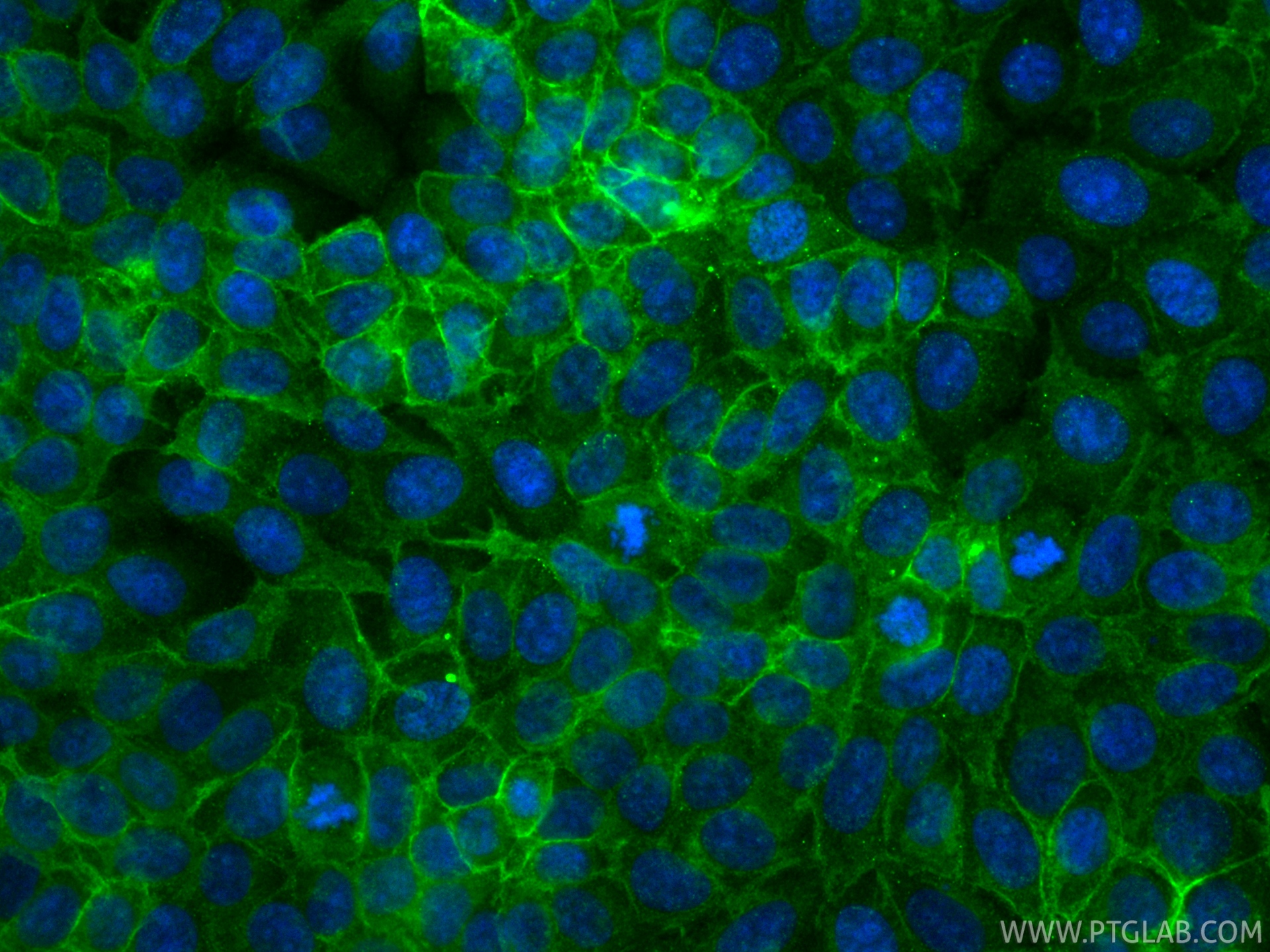 IF Staining of MCF-7 using CL488-81793-13 IF Staining of MCF-7 using CL488-81793-13