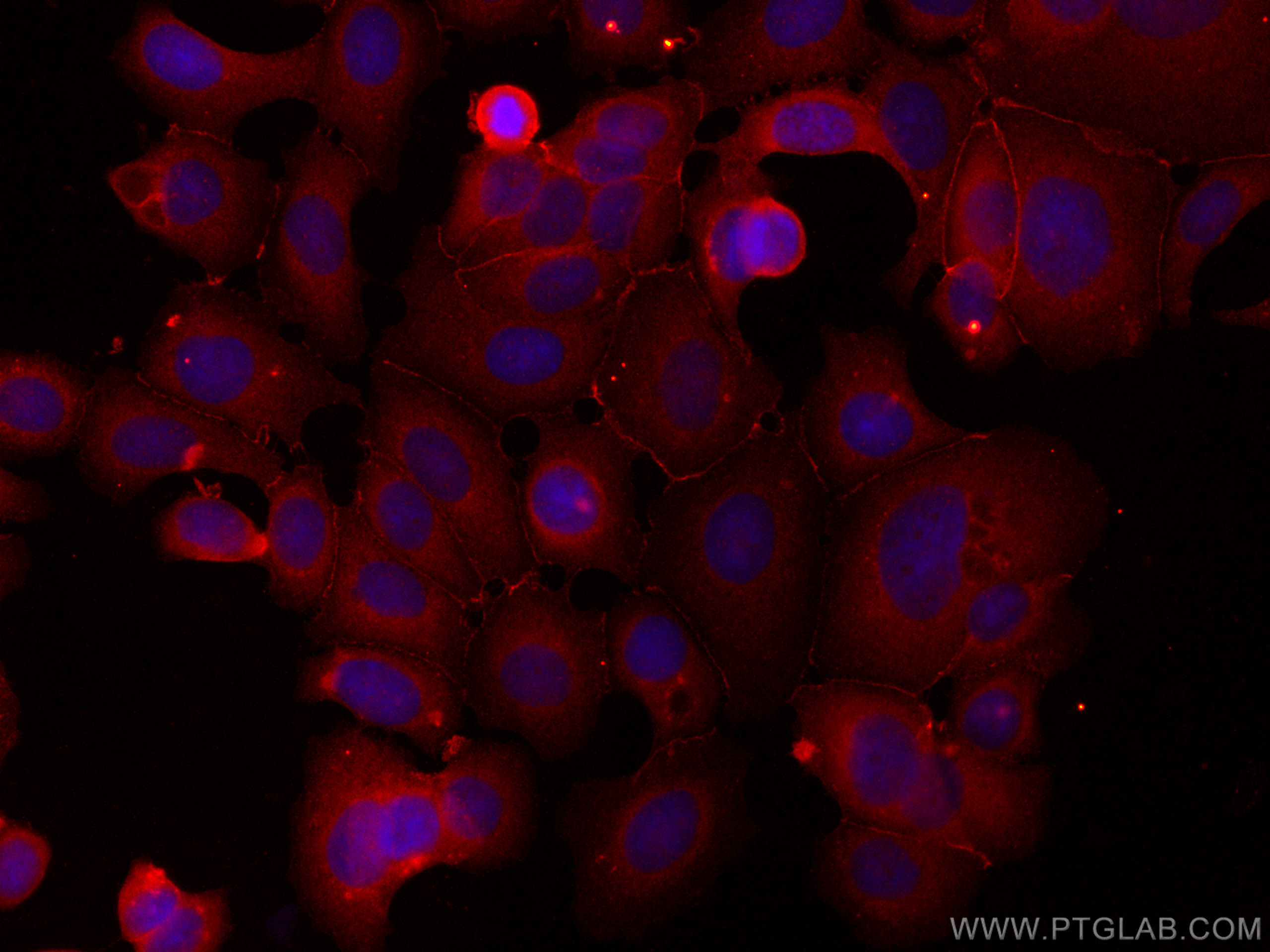 IF Staining of MCF-7 using CL594-66180