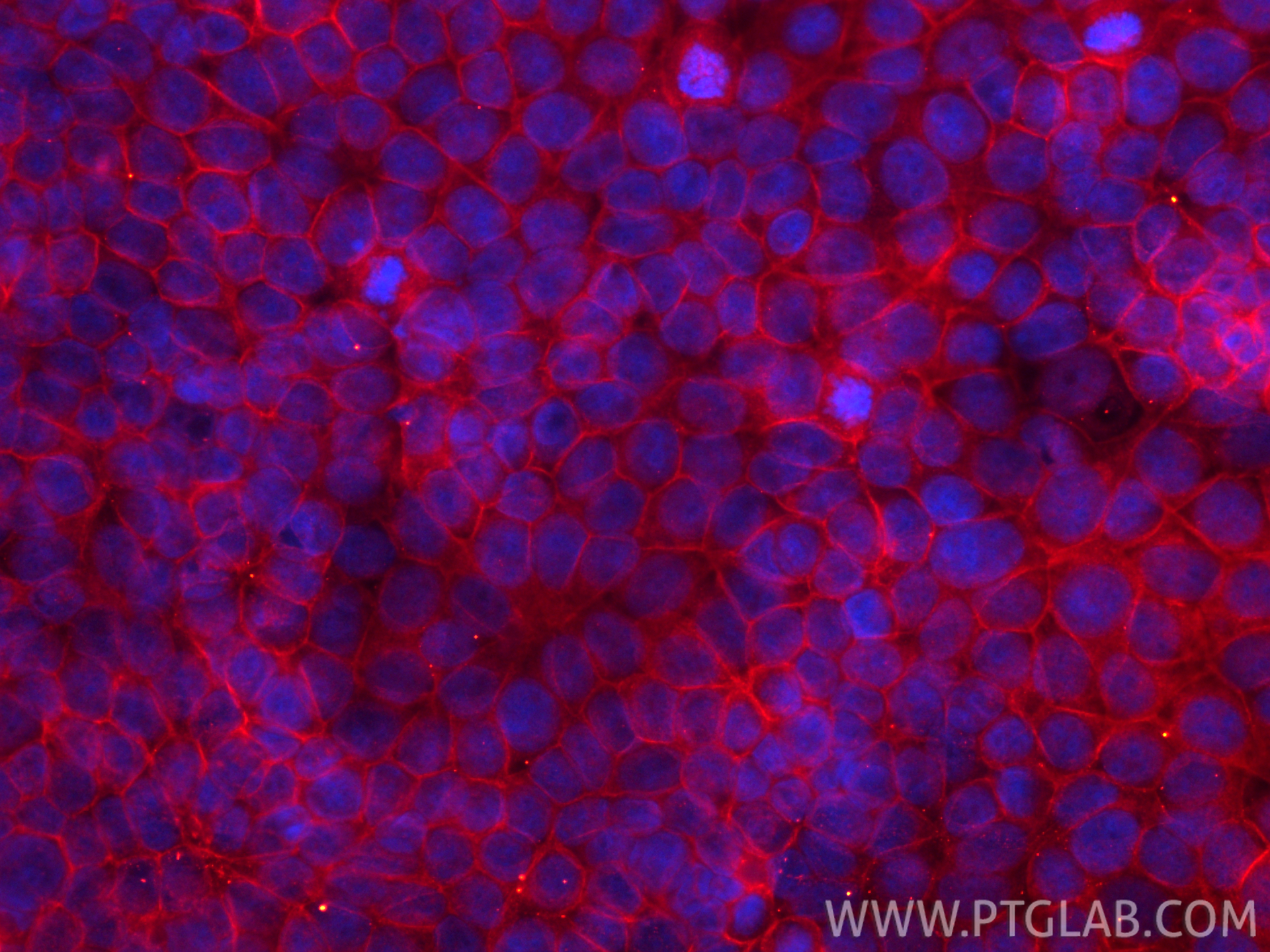 IF Staining of MCF-7 using CL594-66180 IF Staining of MCF-7 using CL594-66180