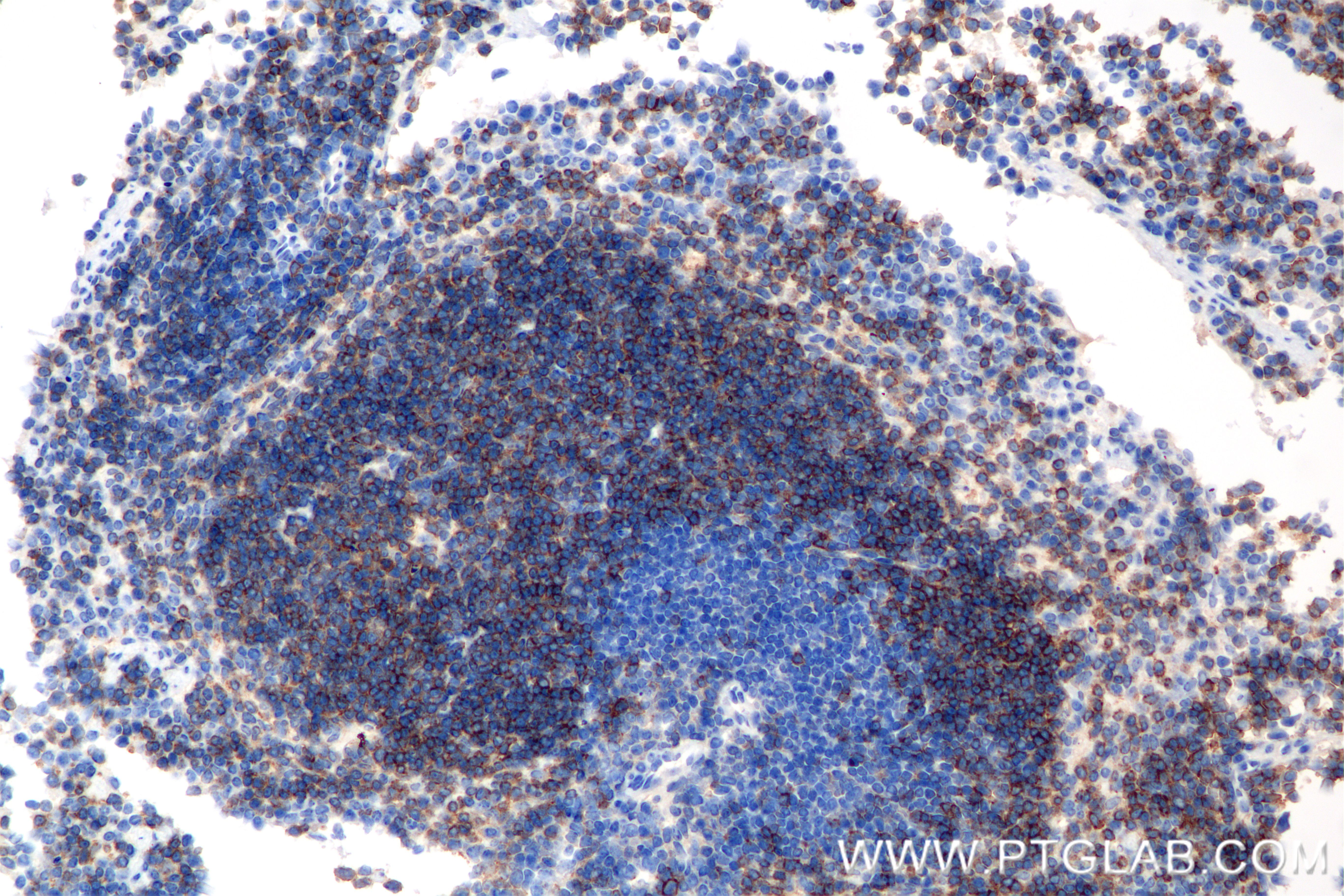 IHC staining of mouse spleen using 85208-5-RR