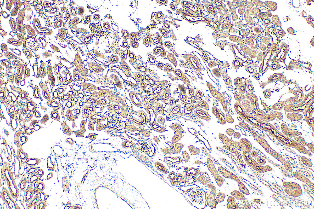 IHC staining of mouse kidney using 32131-1-AP