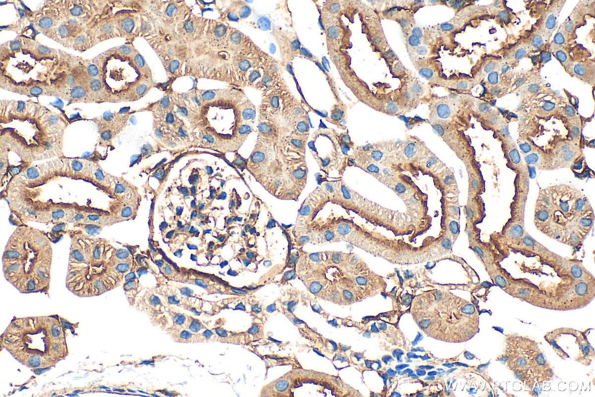 IHC staining of mouse kidney using 32131-1-AP
