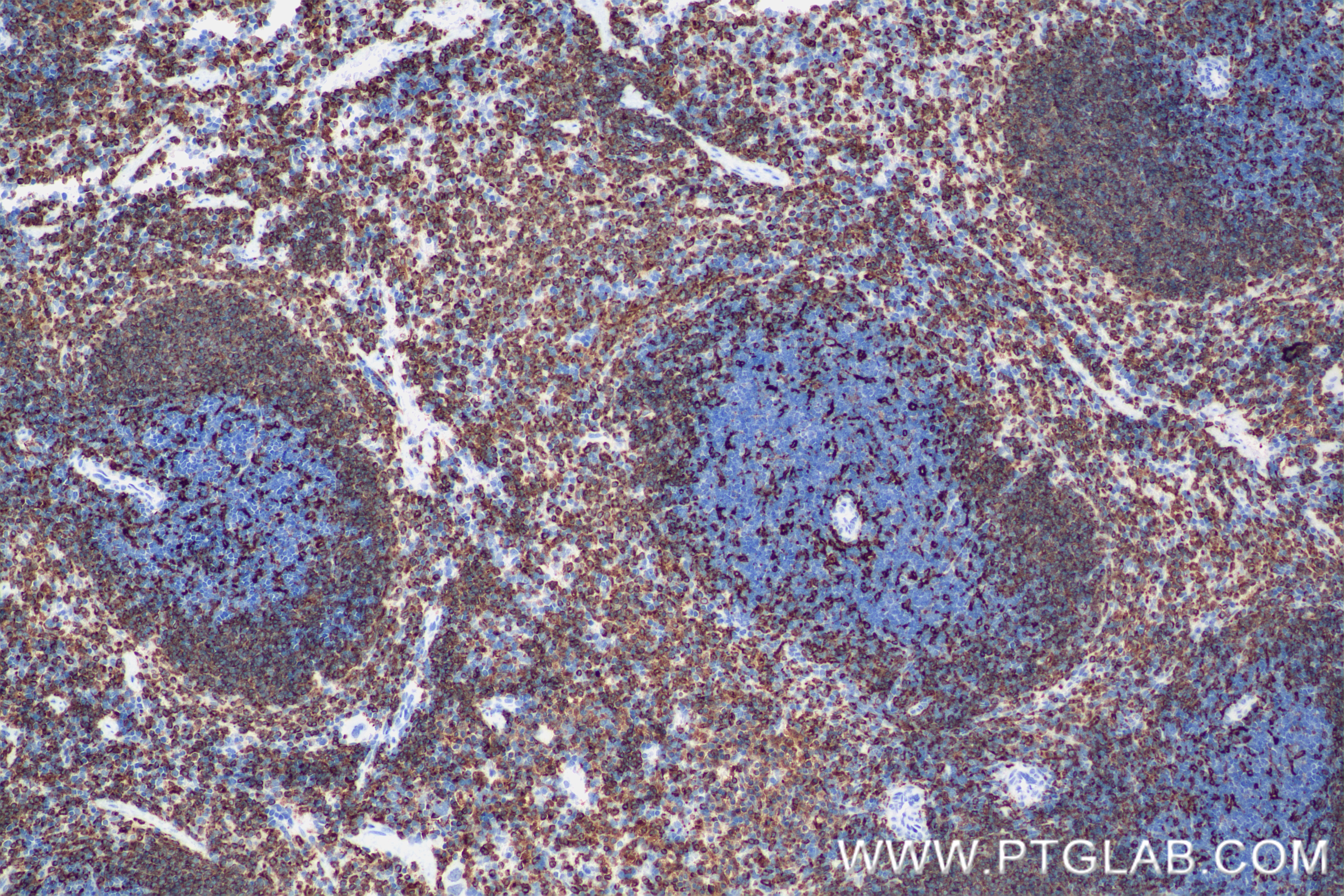 IHC staining of mouse spleen using 85802-2-RR (same clone as 85802-2-PBS)