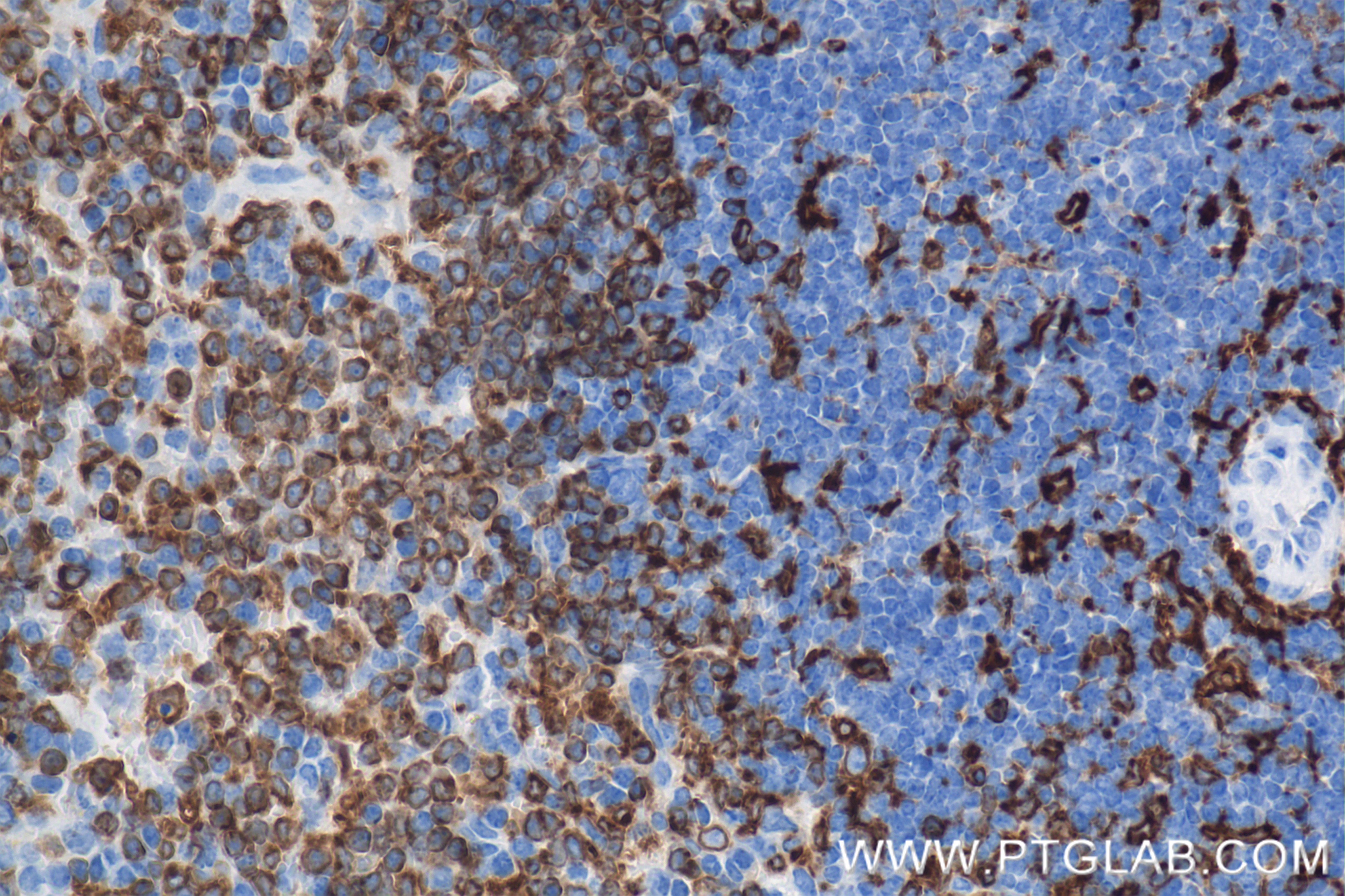 IHC staining of mouse spleen using 85802-2-RR (same clone as 85802-2-PBS)