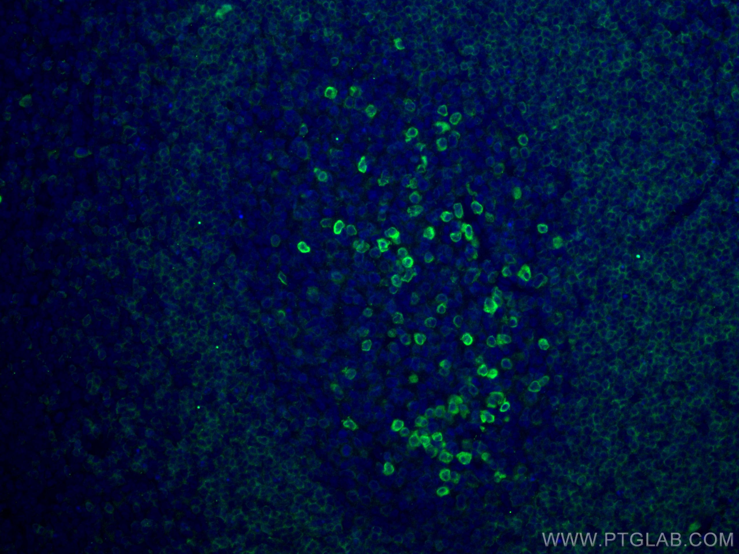 IF Staining of human tonsillitis using 22349-1-AP