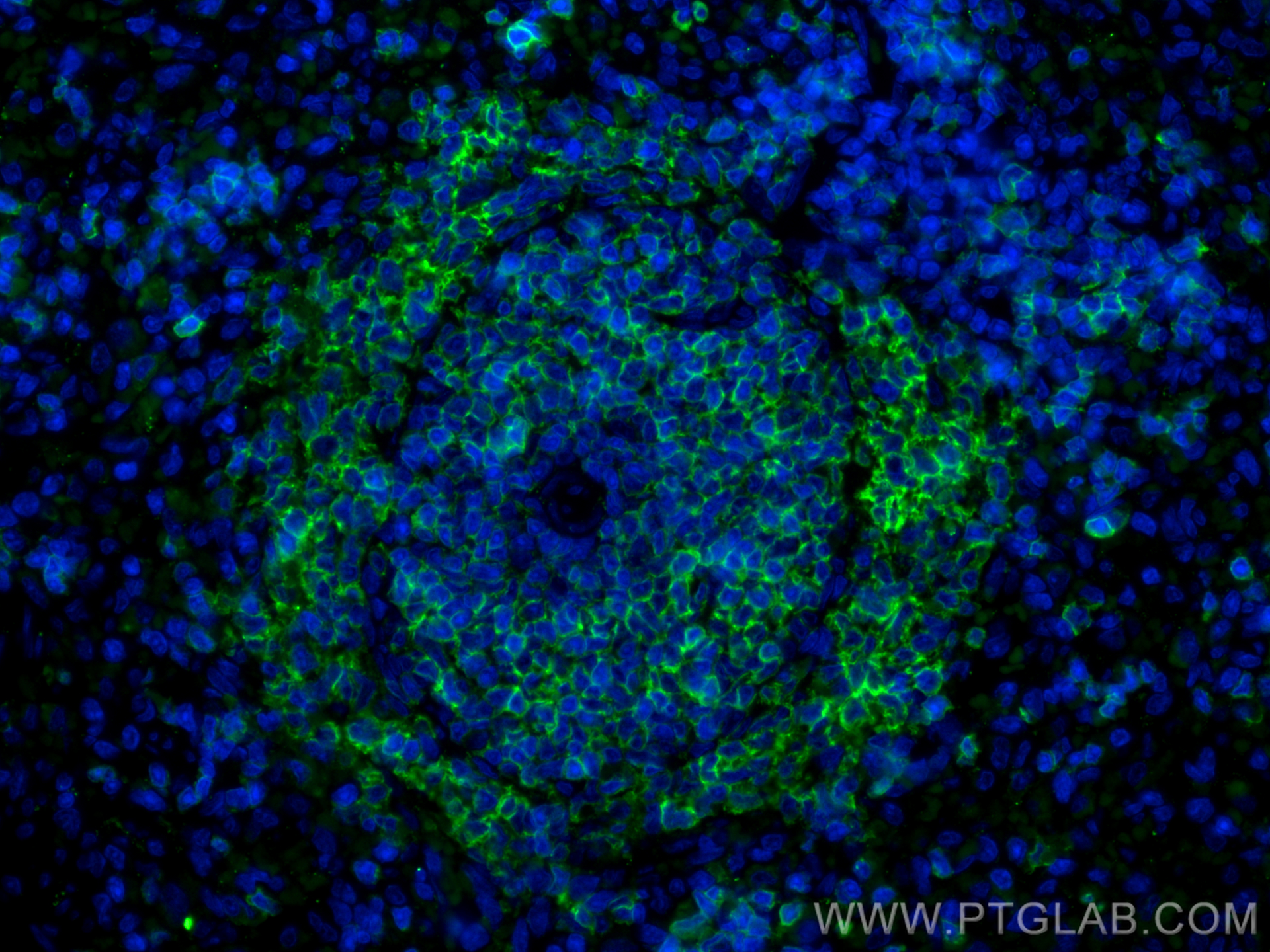 IF Staining of rat spleen using 31887-1-AP