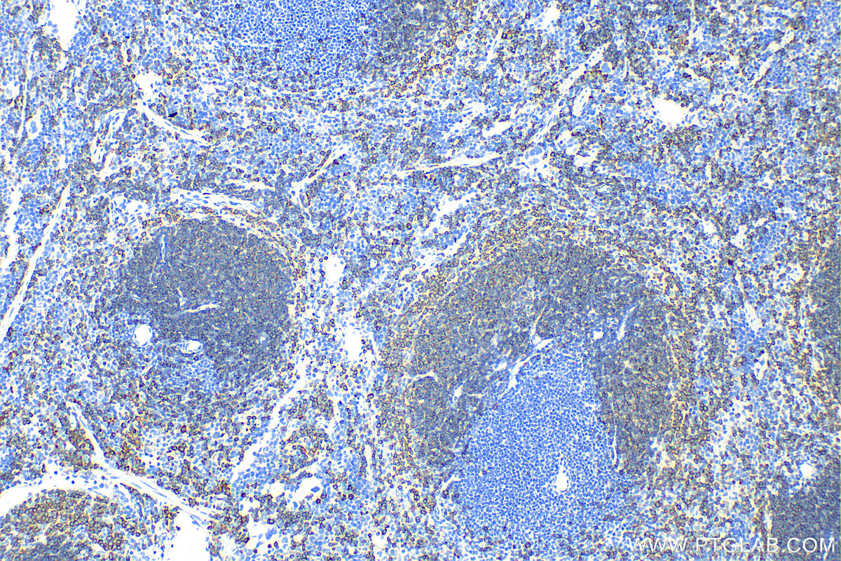 IHC staining of mouse spleen using 31887-1-AP