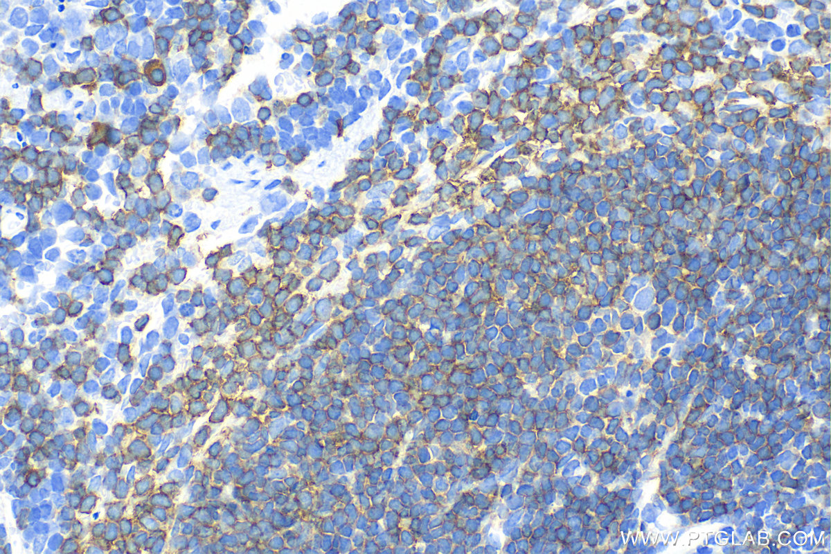 IHC staining of mouse spleen using 31887-1-AP