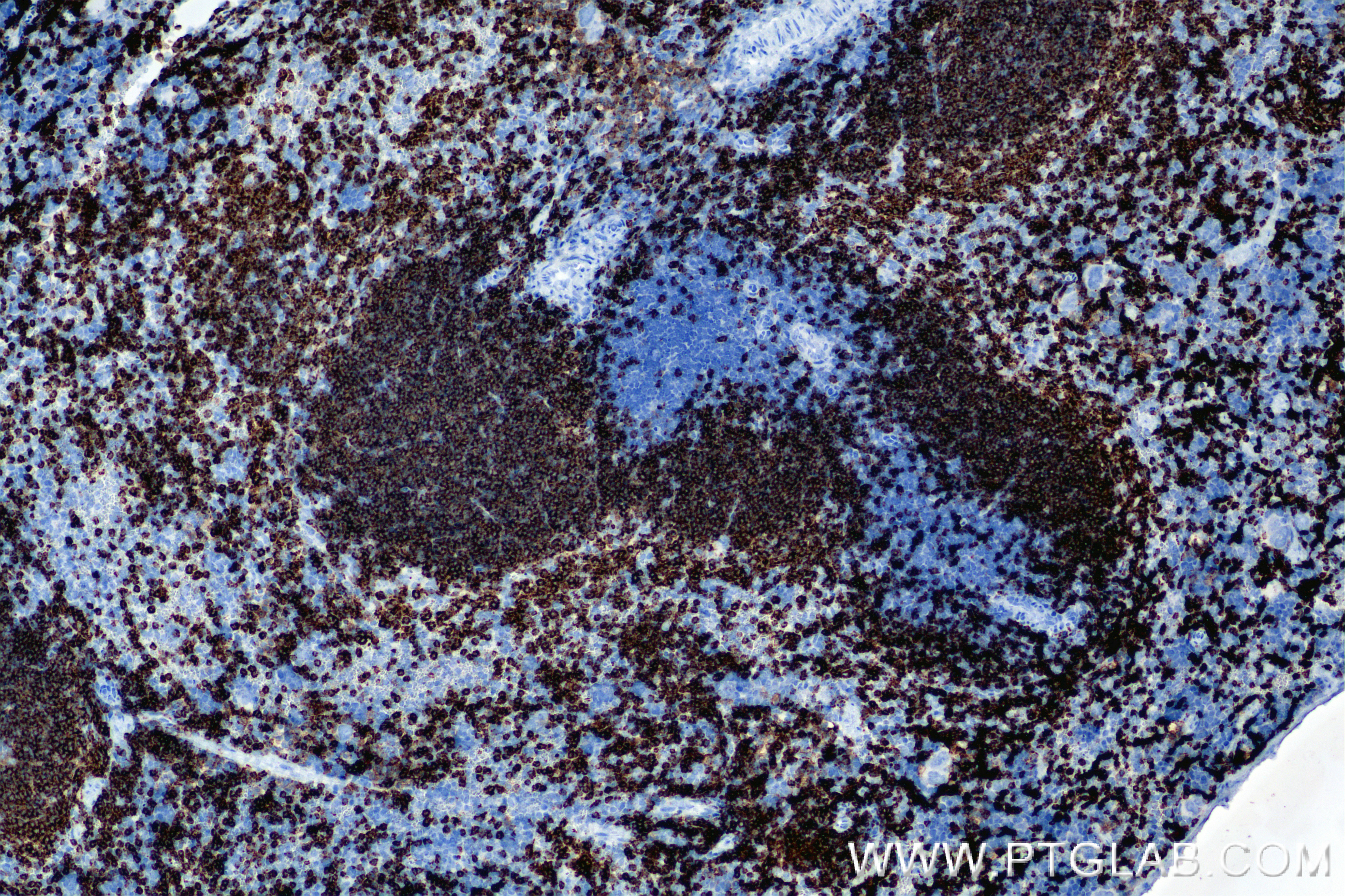 IHC staining of mouse spleen using 85881-3-RR (same clone as 85881-3-PBS)
