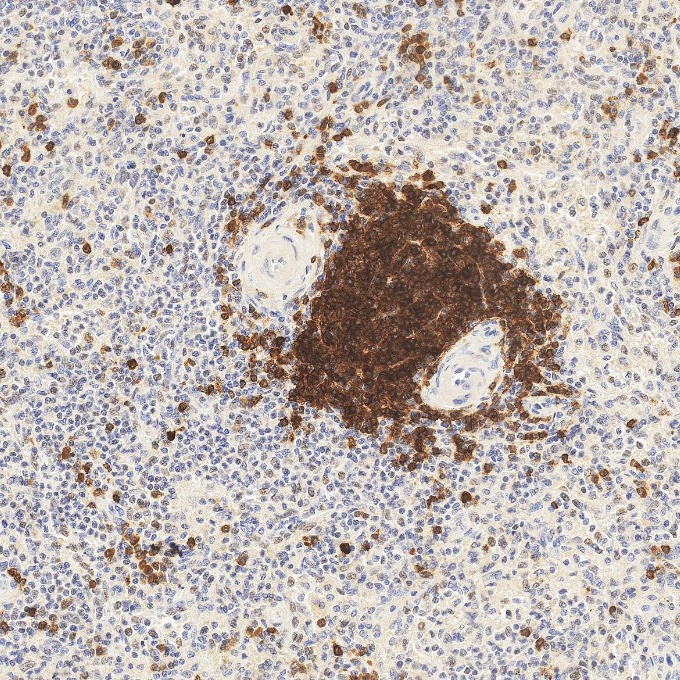 IHC staining of human spleen using 84236-4-RR IHC staining of human spleen using 84236-4-RR