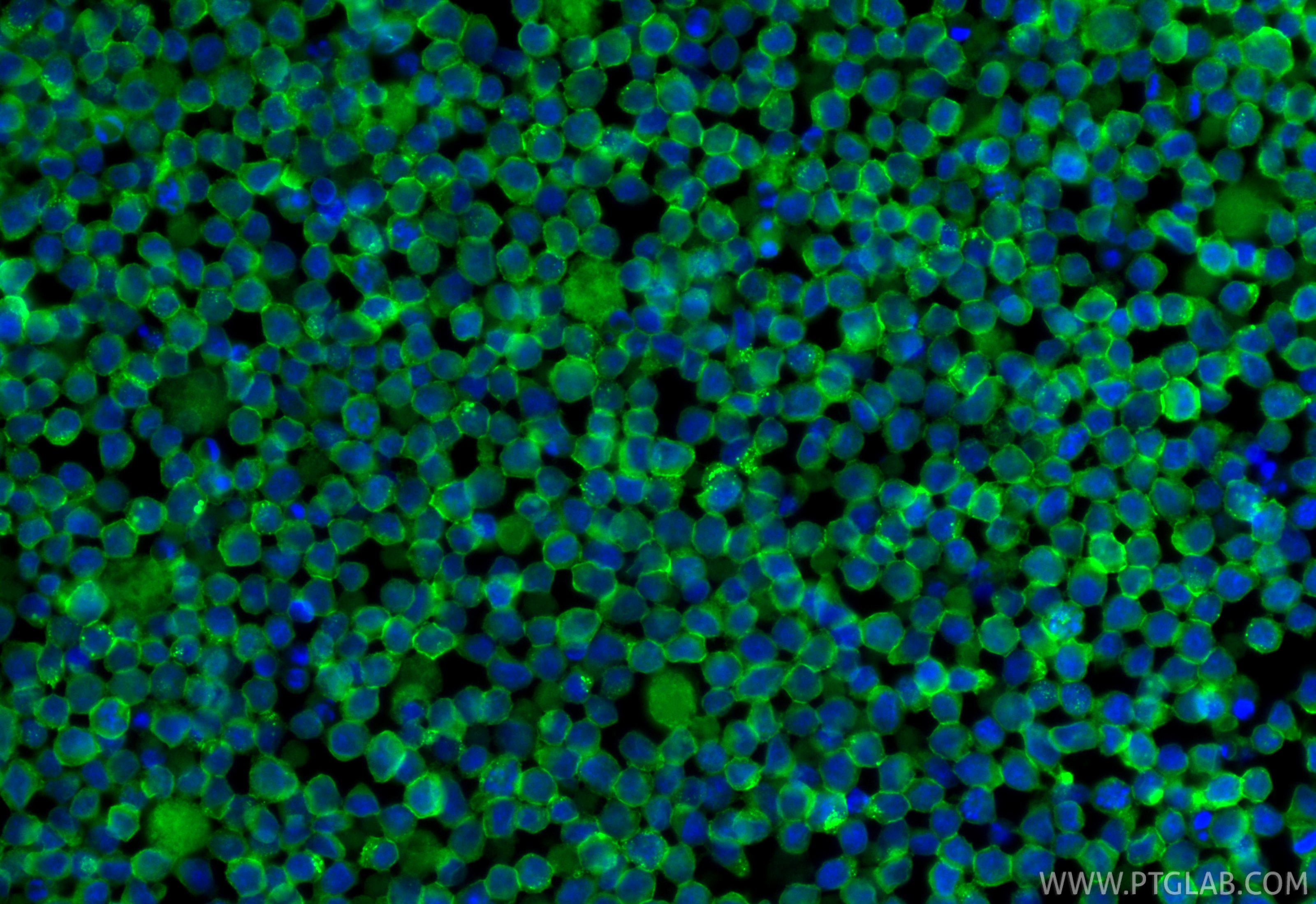 IF Staining of Ramos using CL488-84236-5 IF Staining of Ramos using CL488-84236-5
