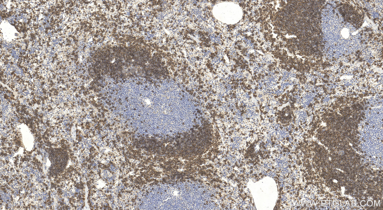 IHC staining of mouse spleen using 32152-1-AP