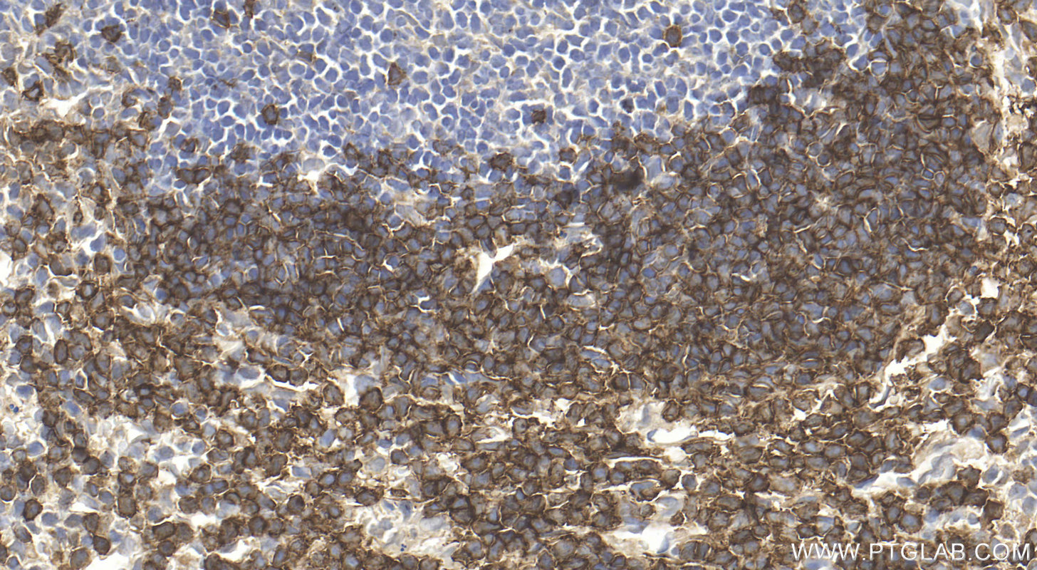 IHC staining of mouse spleen using 32152-1-AP