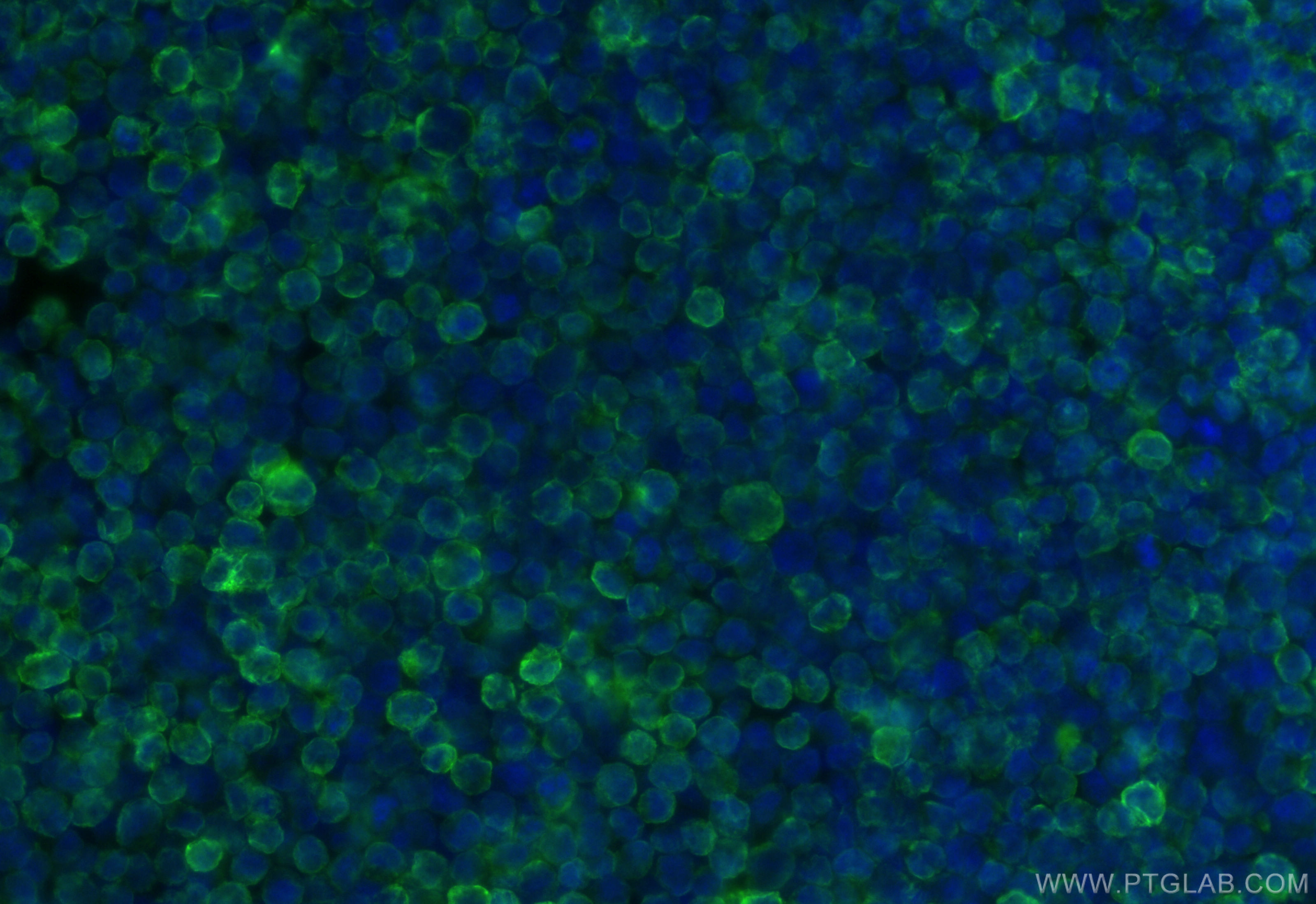 IF Staining of raji using CL488-84234-5