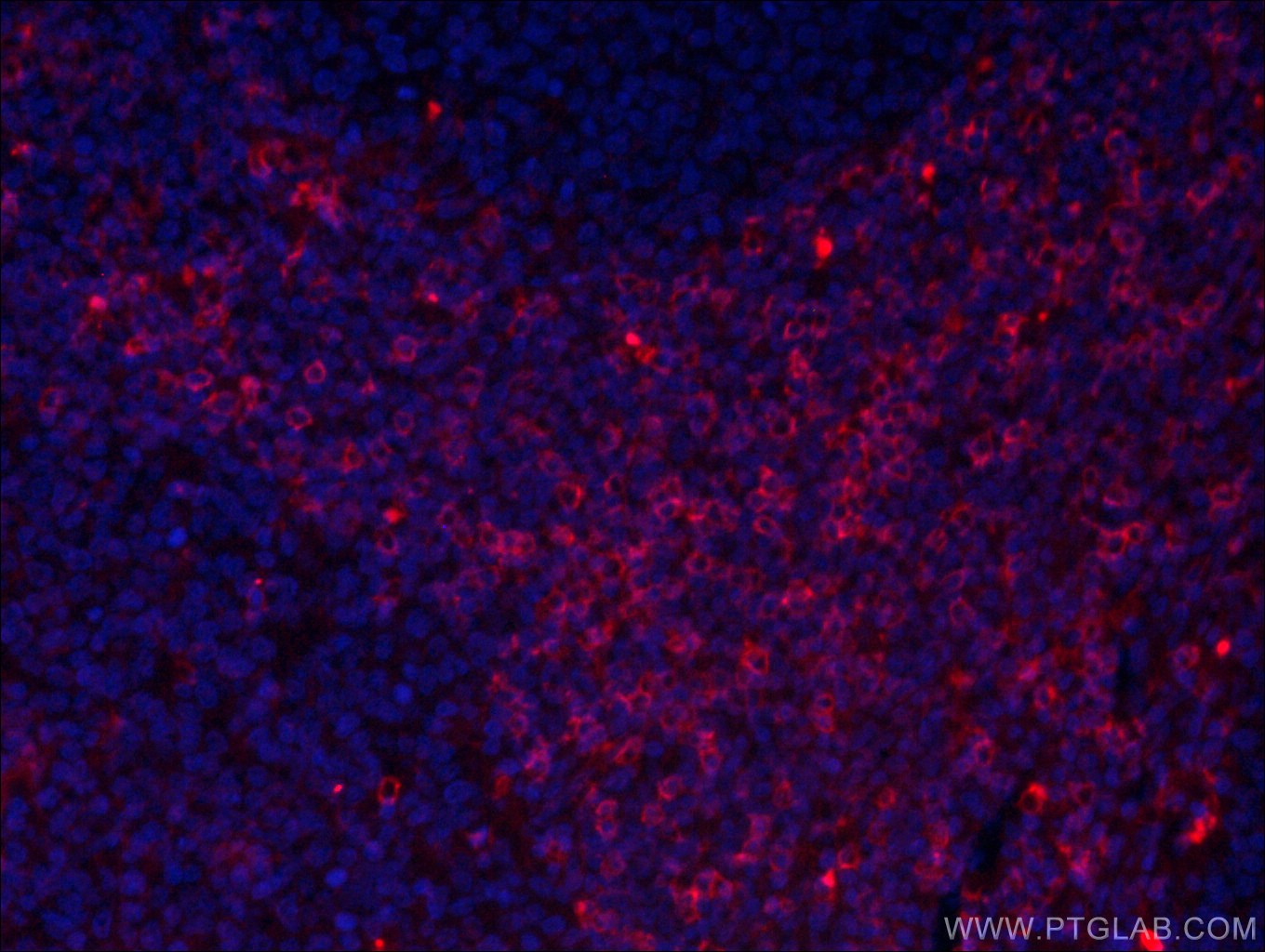 IF Staining of human tonsillitis using CL594-66868