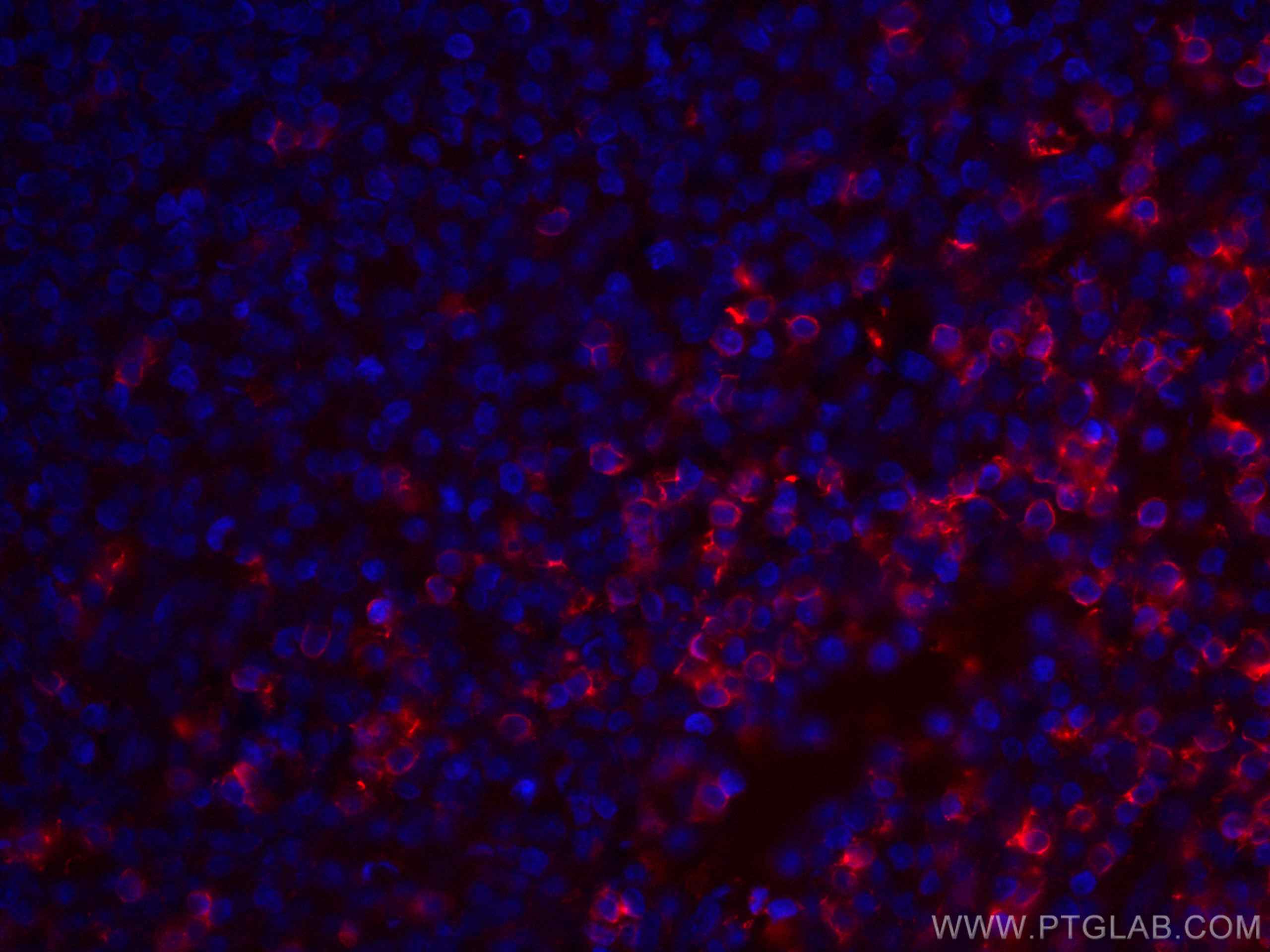 IF Staining of human tonsillitis using CL594-66868