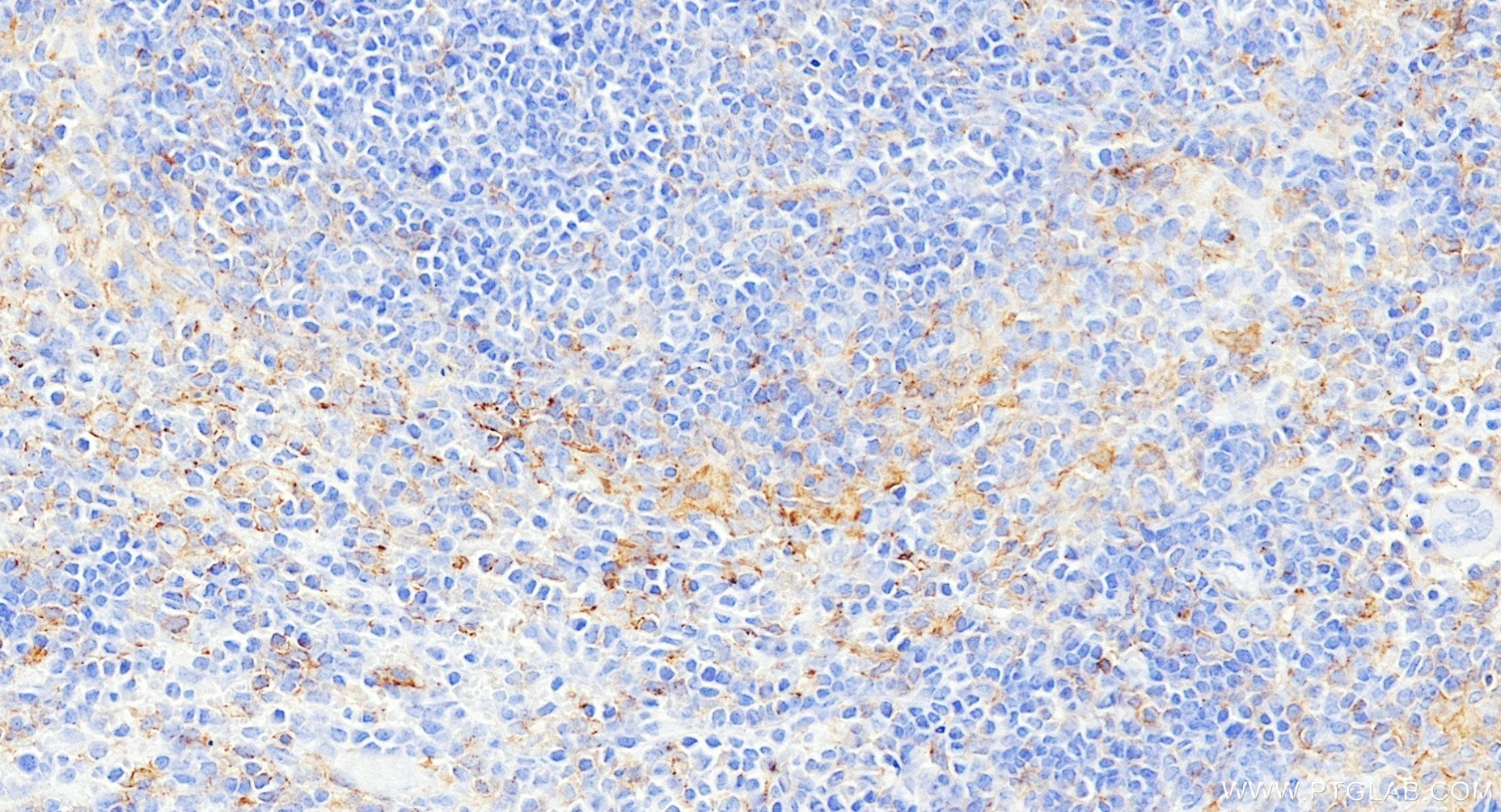 IHC staining of mouse spleen using 84137-5-RR IHC staining of mouse spleen using 84137-5-RR