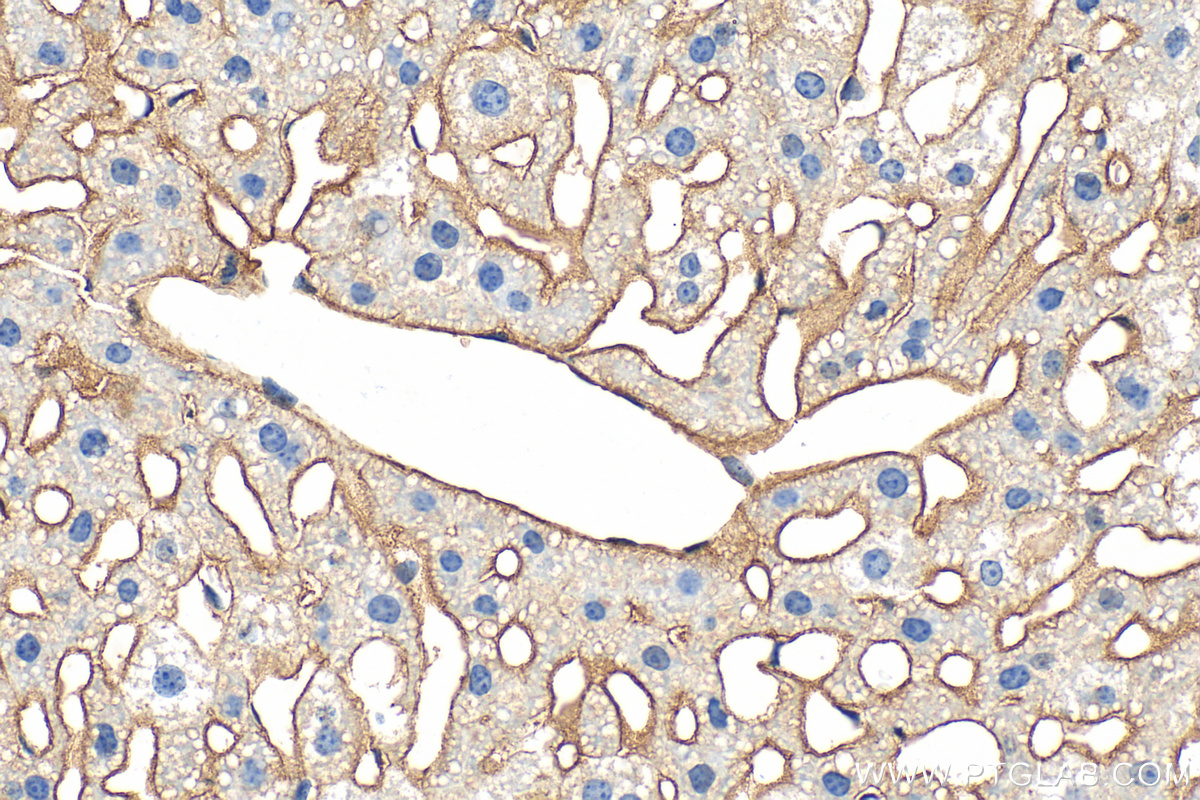Immunohistochemical analysis of paraffin-embedded mouse liver tissue slide using 33170-1-AP (CD81 antibody) at dilution of 1:400 (under 40x lens). Heat mediated antigen retrieval with Tris-EDTA buffer (pH 9.0). IHC staining of mouse liver using 33170-1-AP