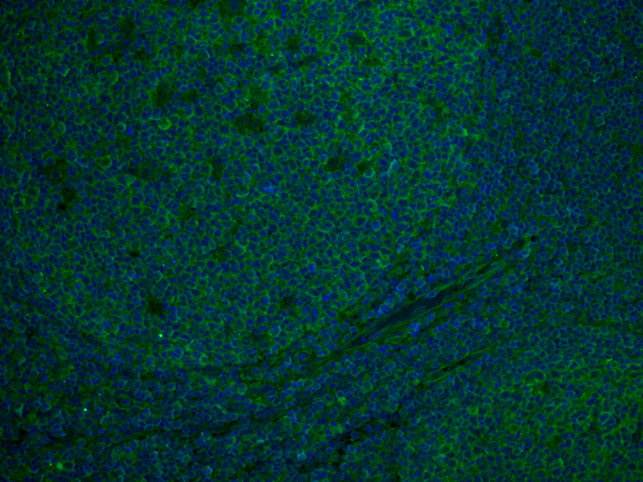 IF Staining of human tonsillitis using 66866-1-Ig (same clone as 66866-1-PBS)