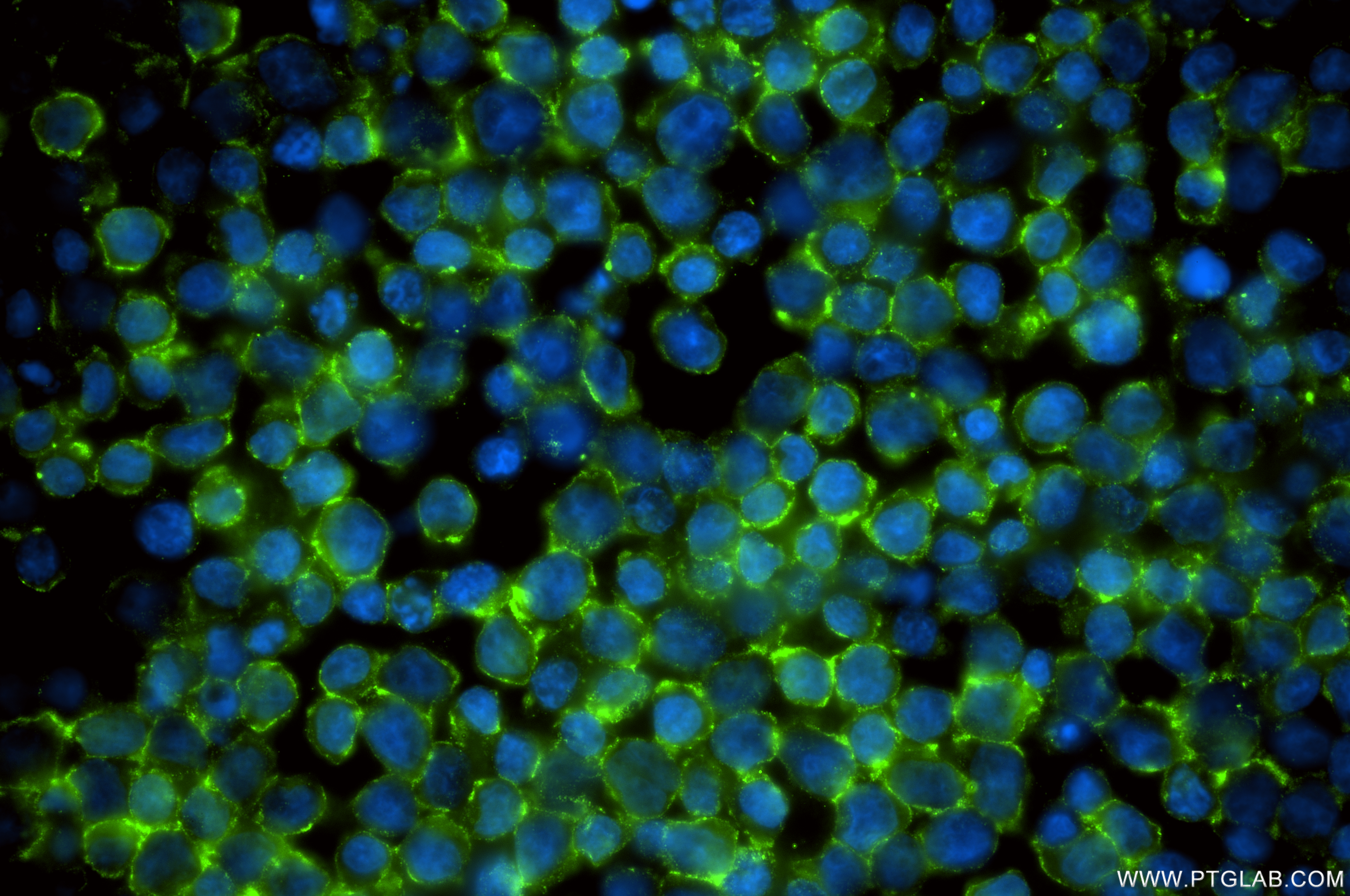 IF Staining of Jurkat using 84644-1-RR